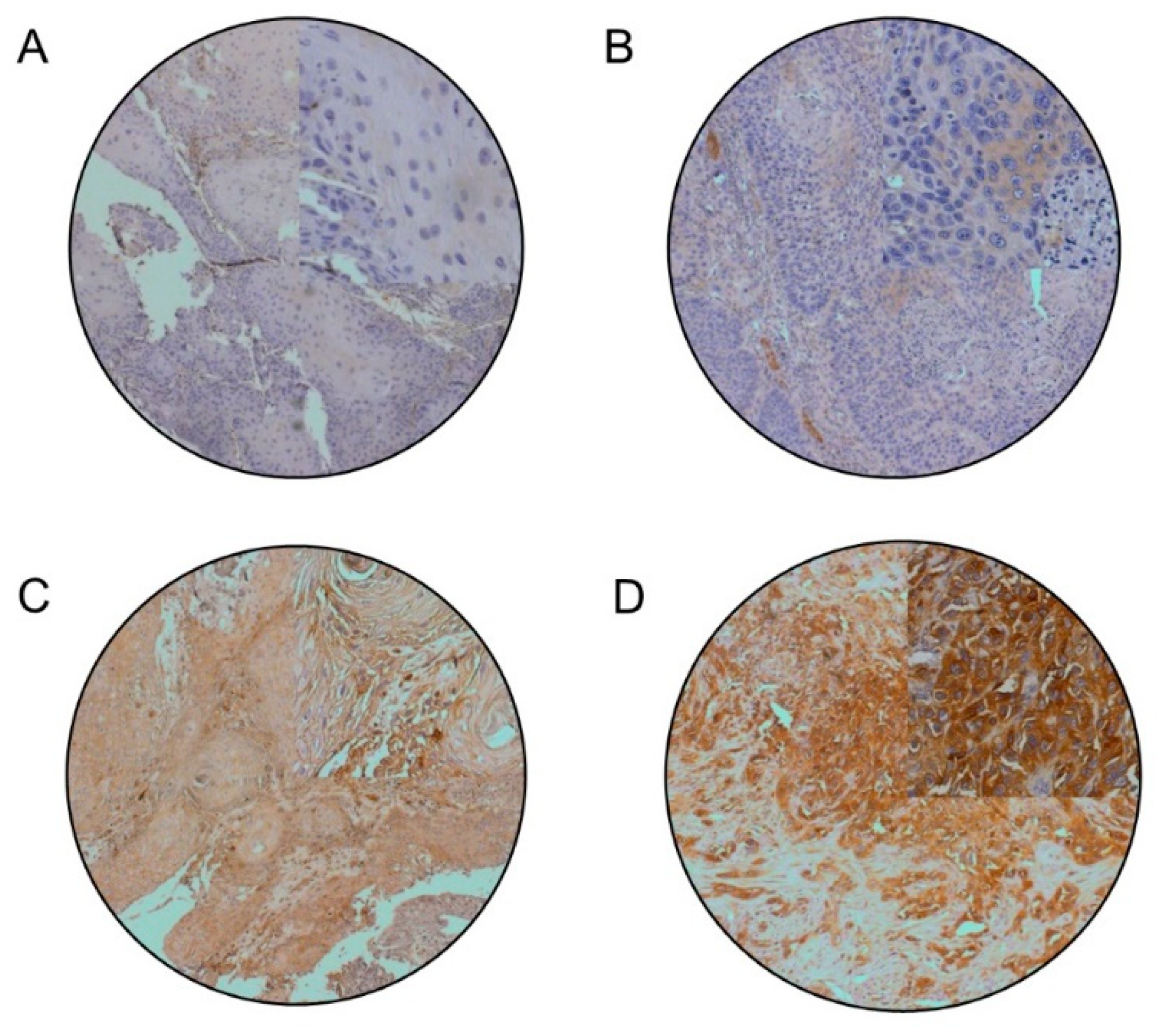 Cancers 13 02082 g001