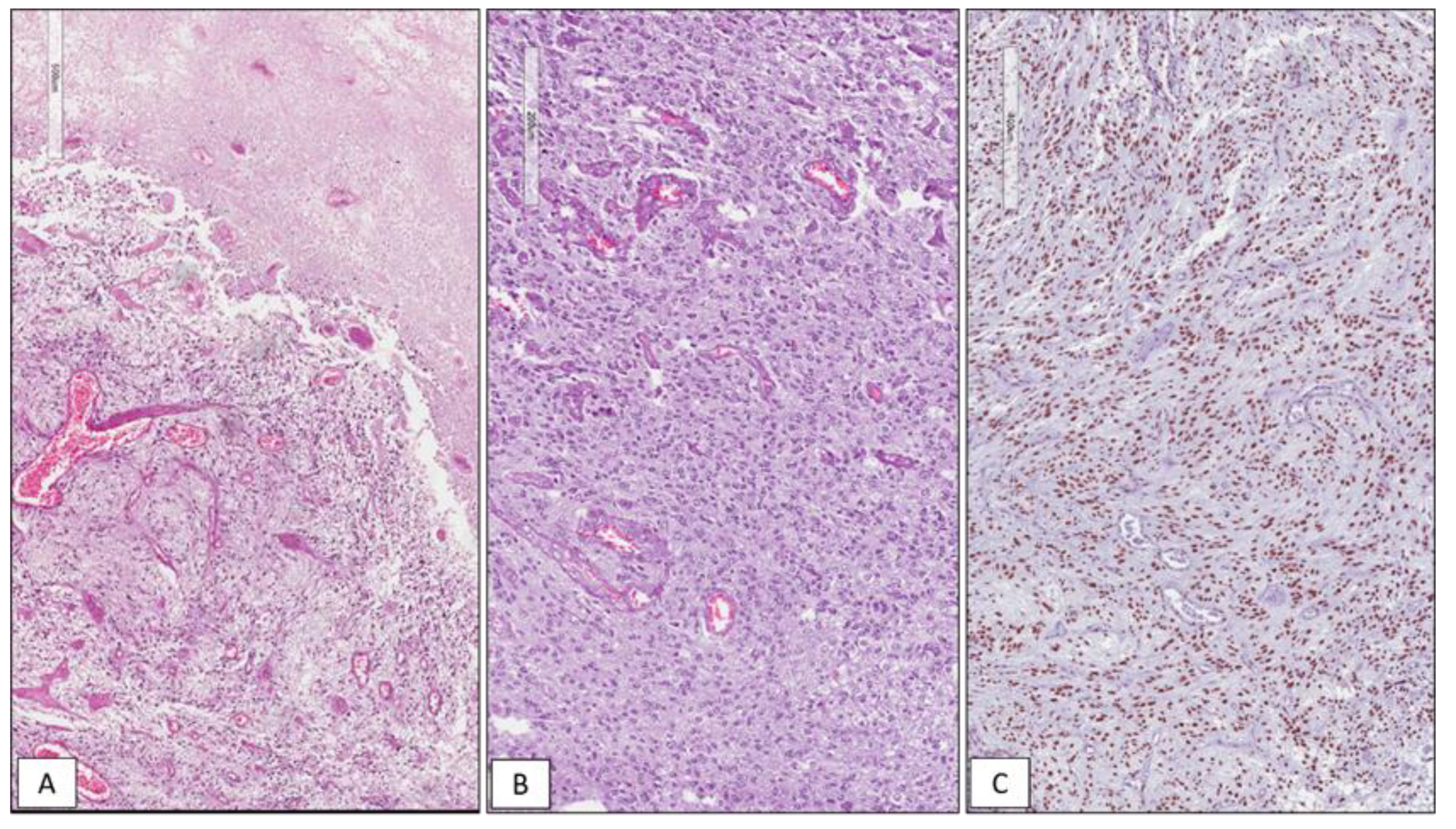 Cancers 13 02086 g001