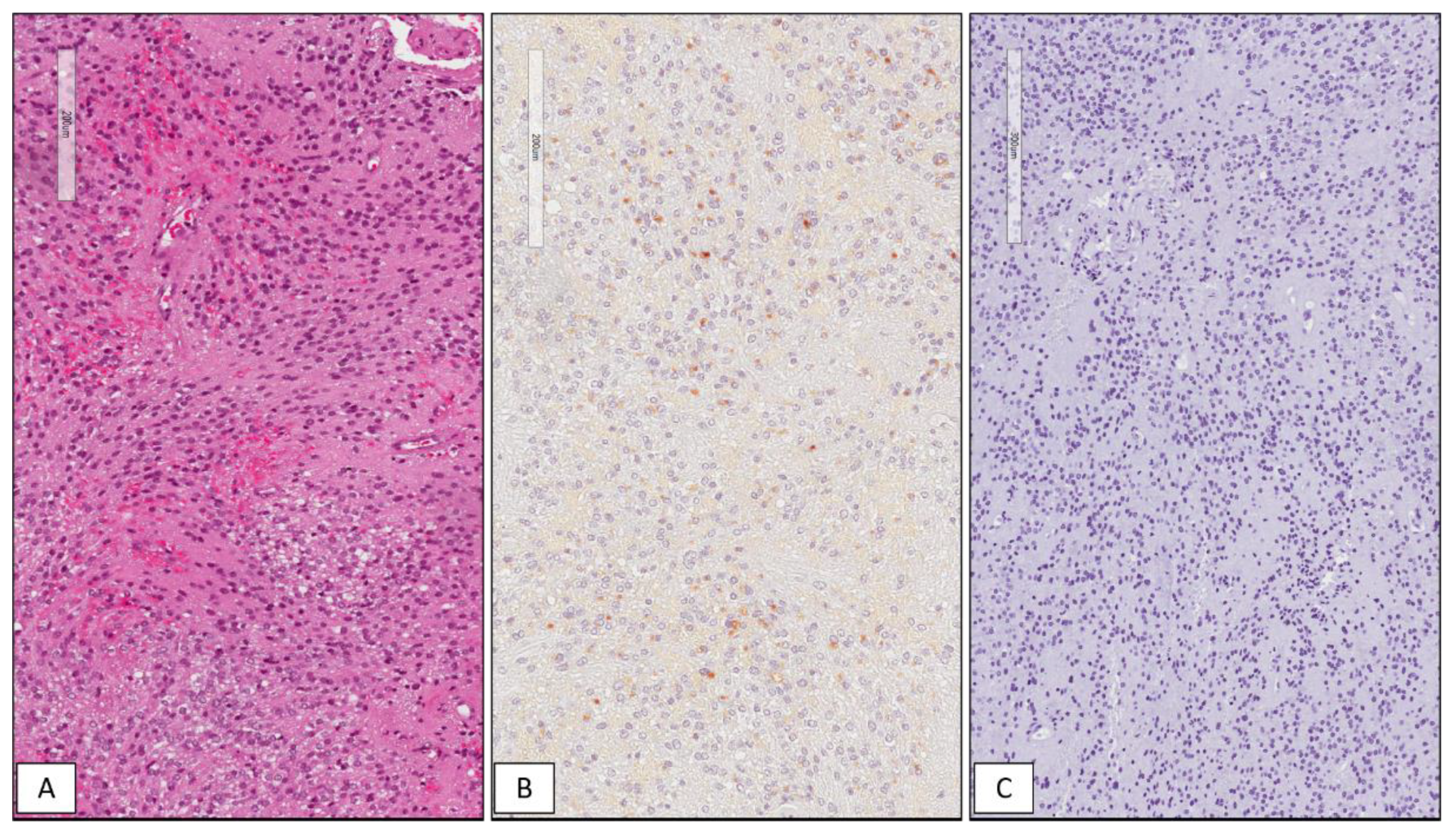 Cancers 13 02086 g003