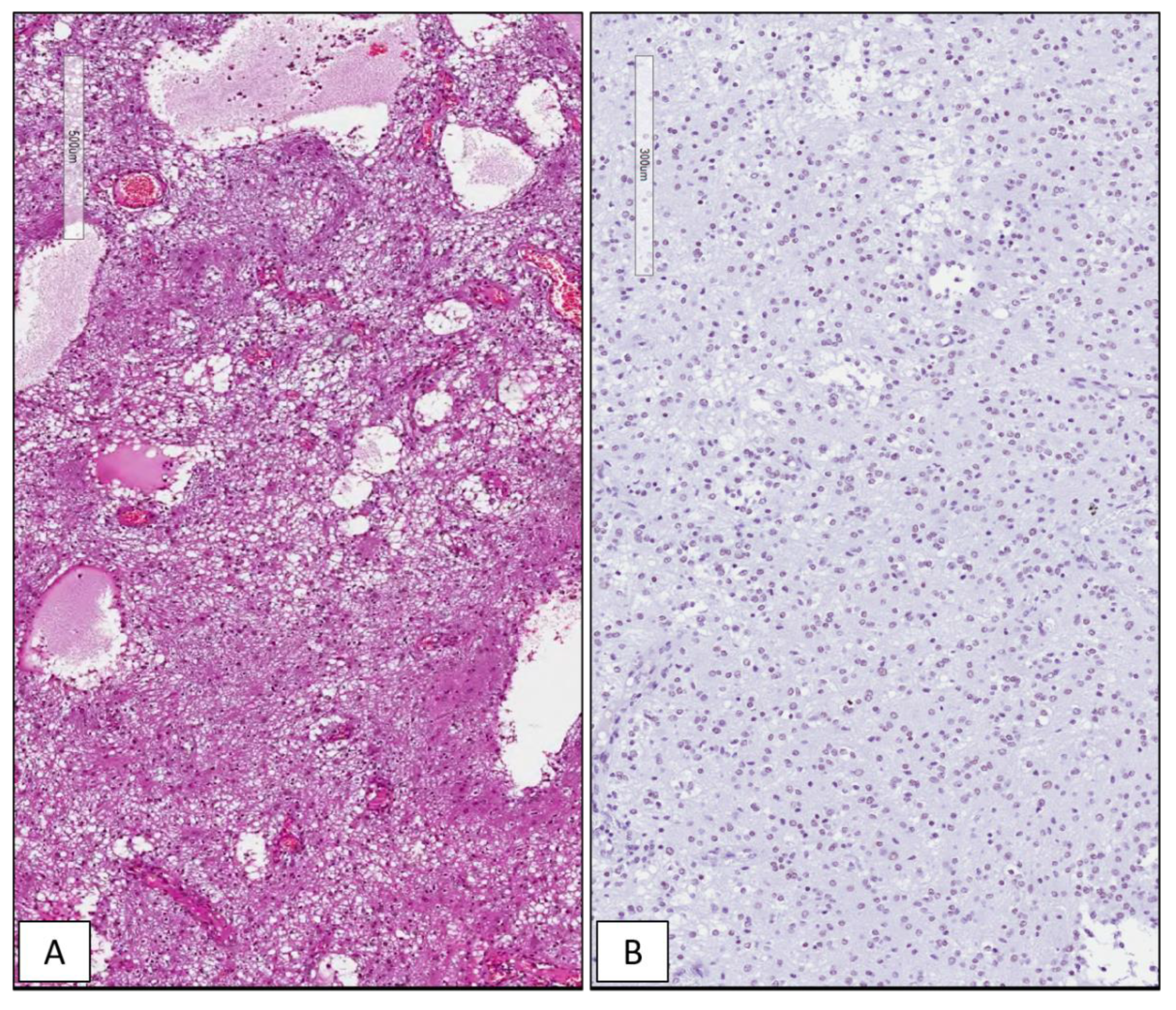 Cancers 13 02086 g004