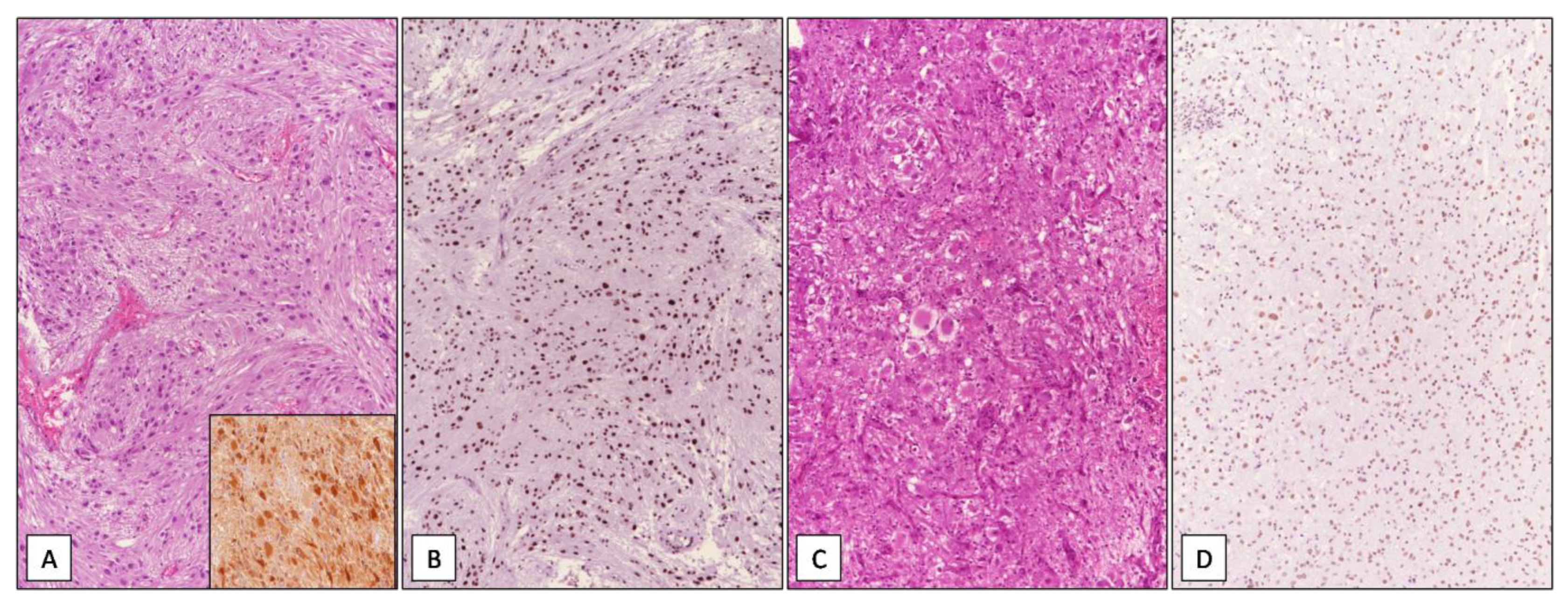 Cancers 13 02086 g005