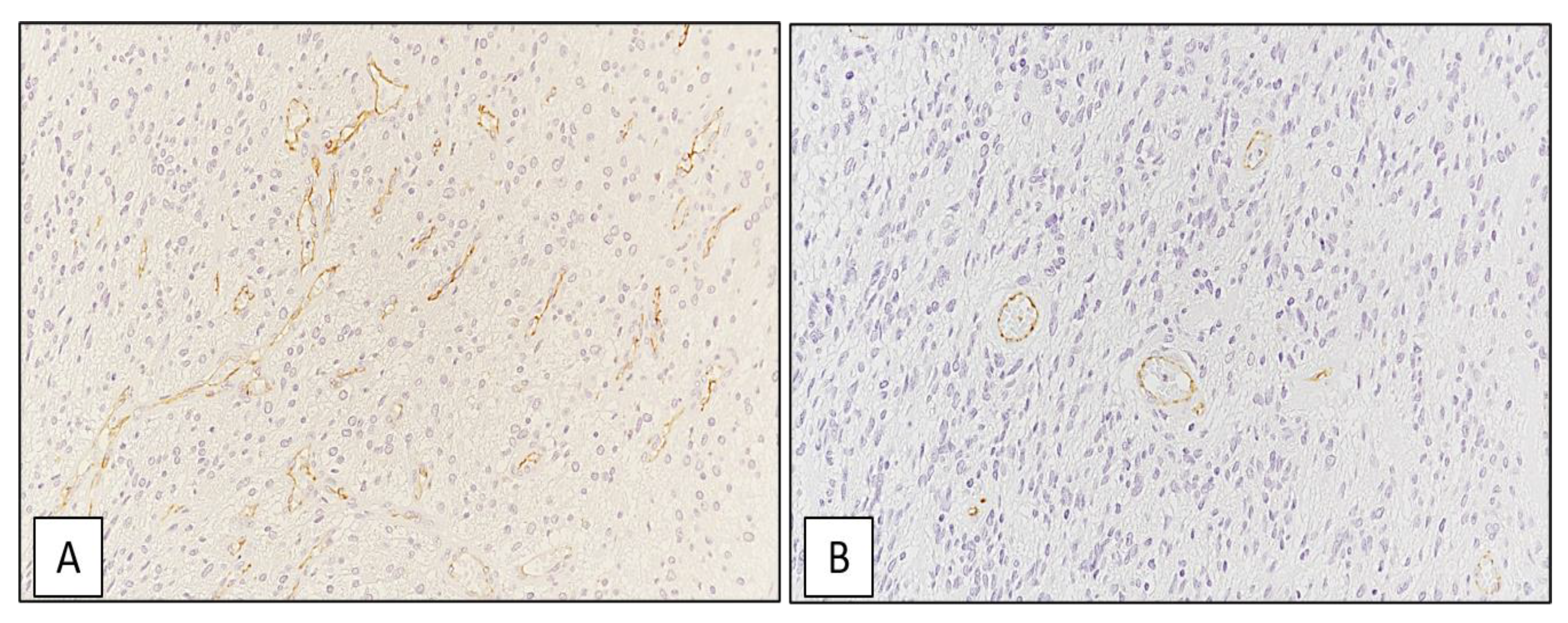 Cancers 13 02086 g008