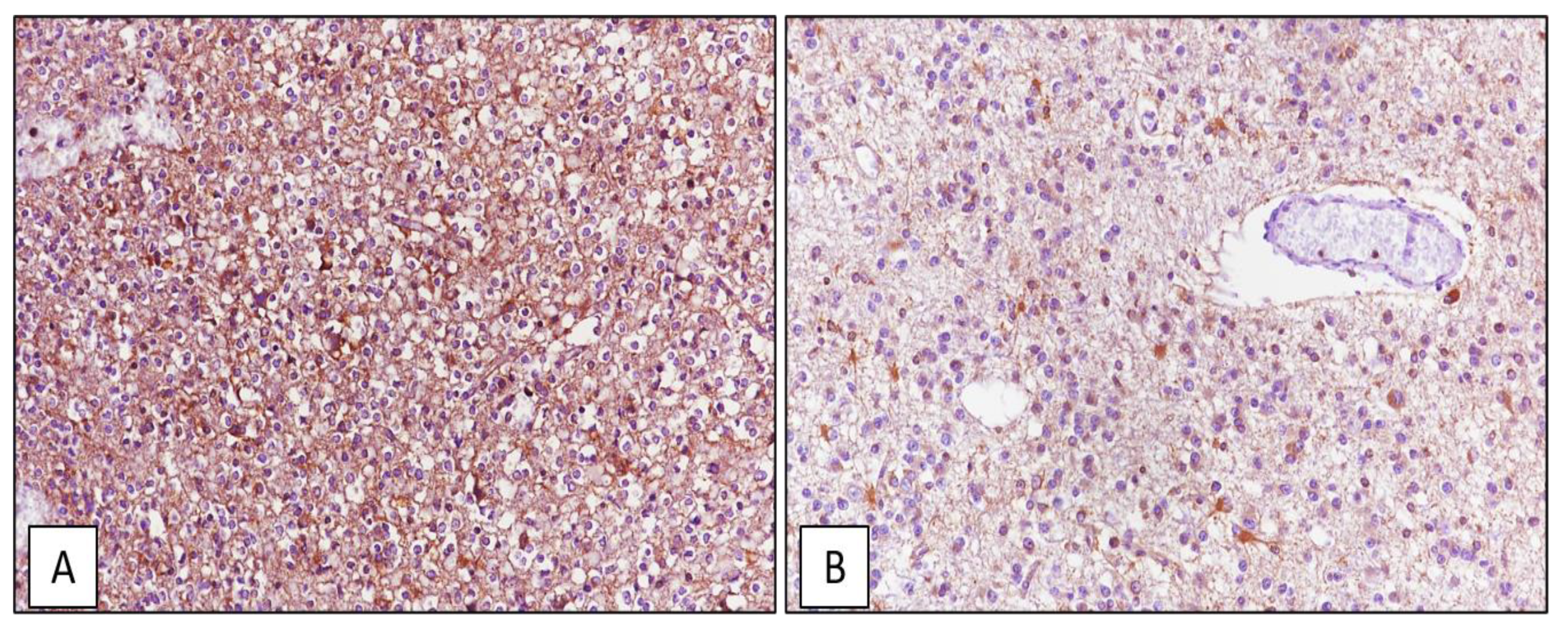 Cancers 13 02086 g010