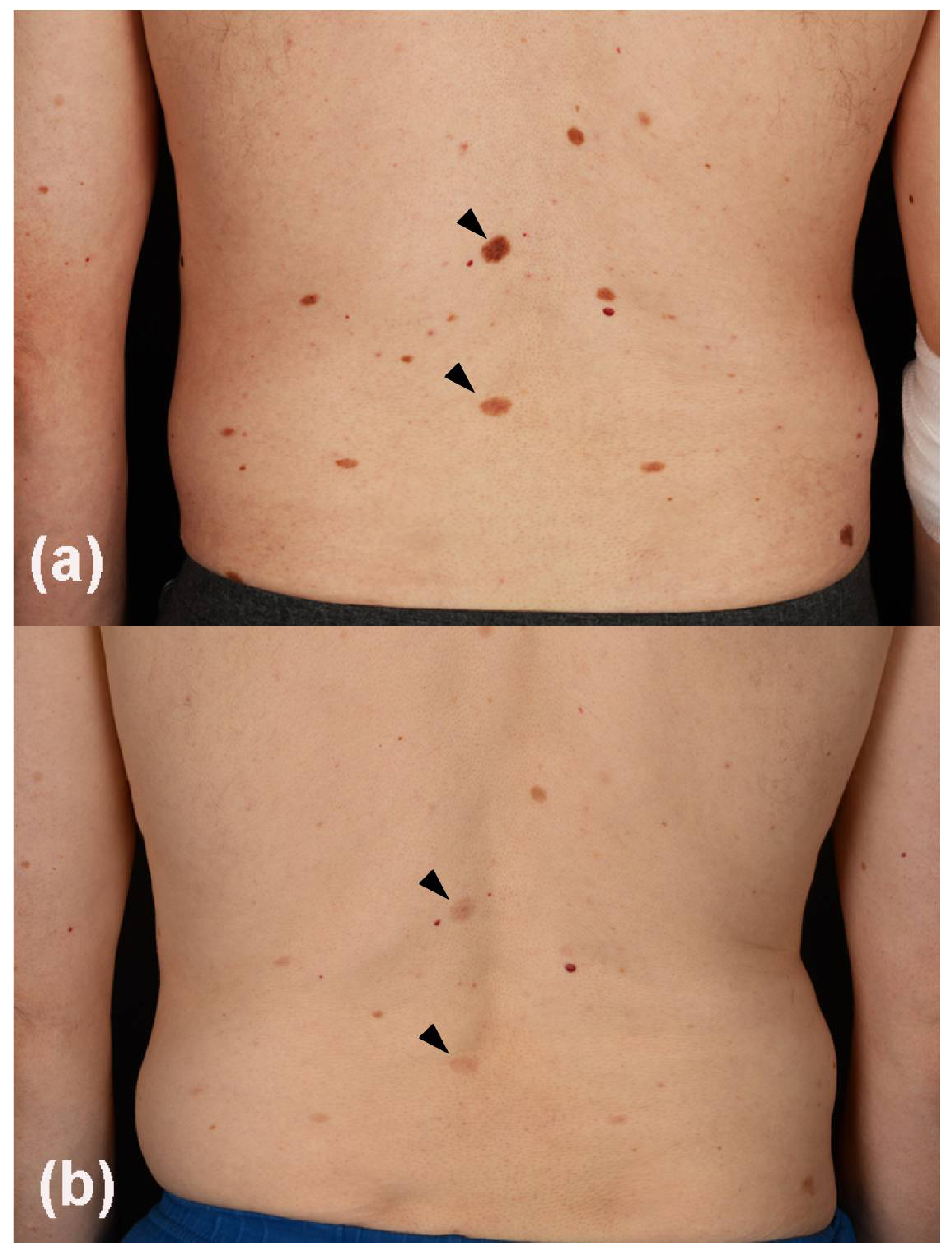 Cancers 13 02090 g002 Cancers 13 02090 g002