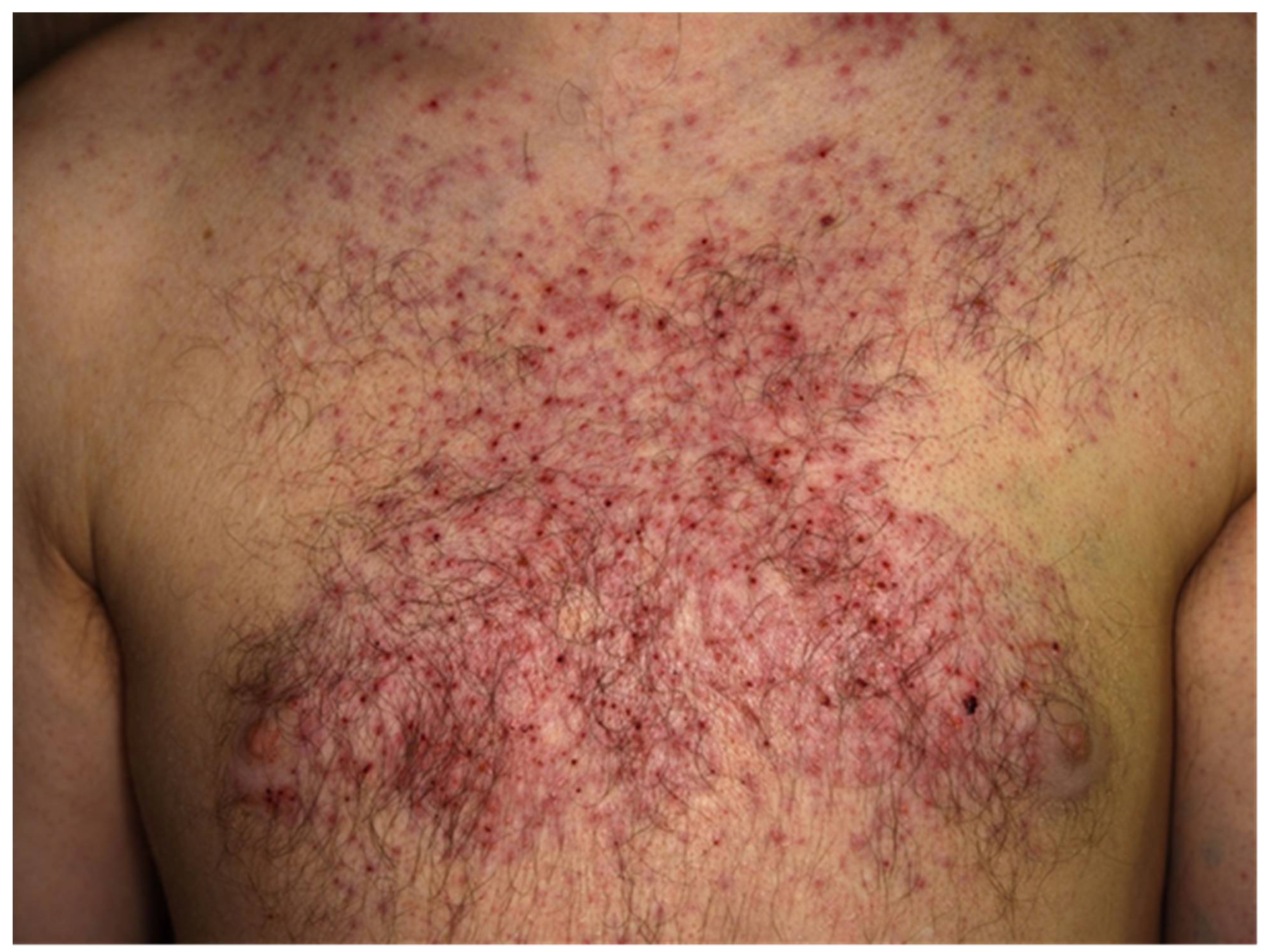 Cancers 13 02090 g004 Cancers 13 02090 g004