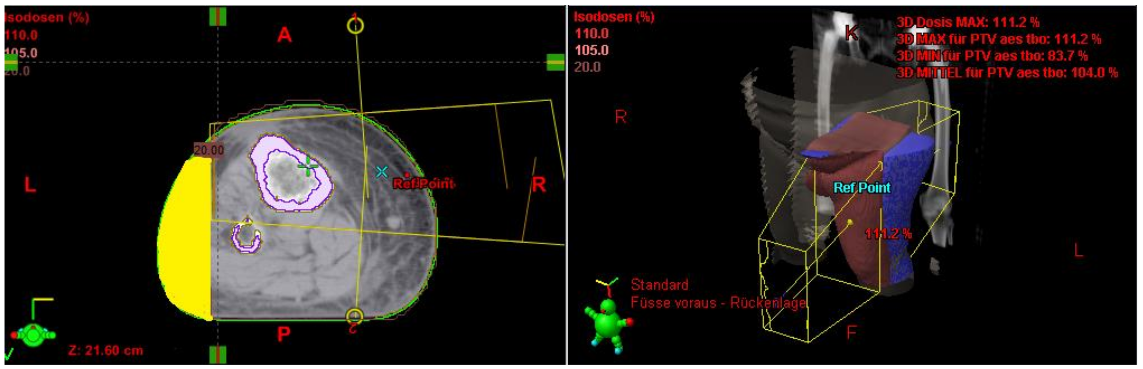Cancers 13 02113 g001 Cancers 13 02113 g001