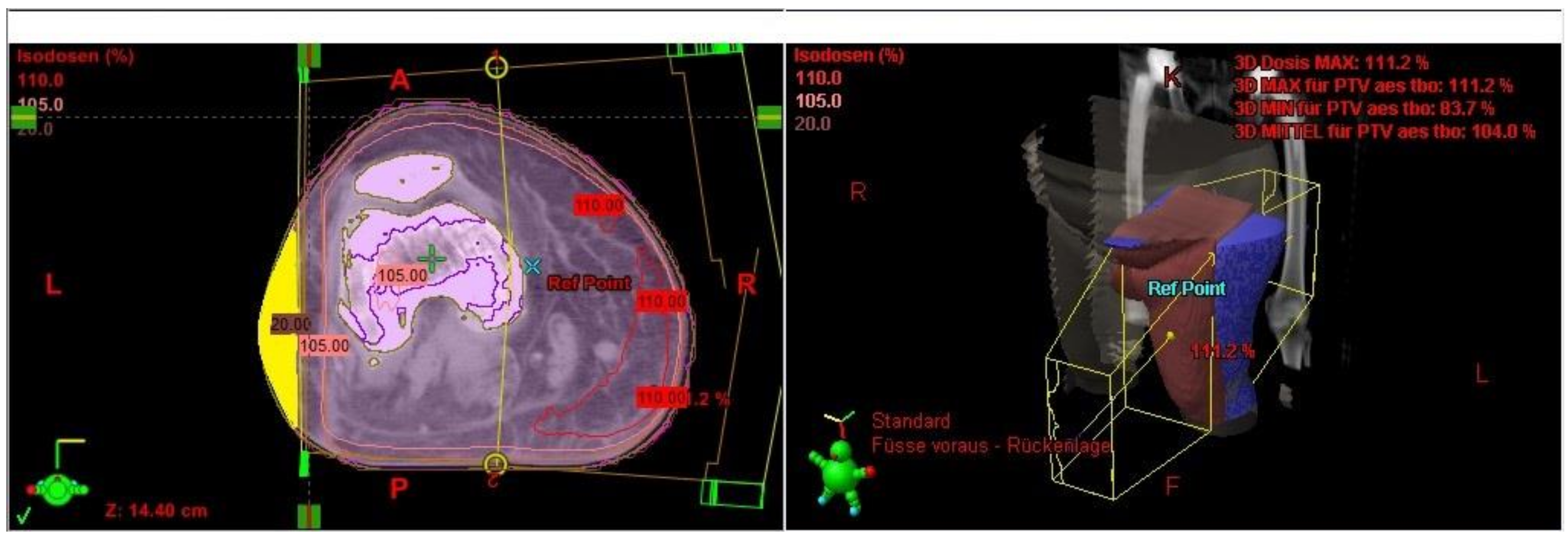 Cancers 13 02113 g002 Cancers 13 02113 g002