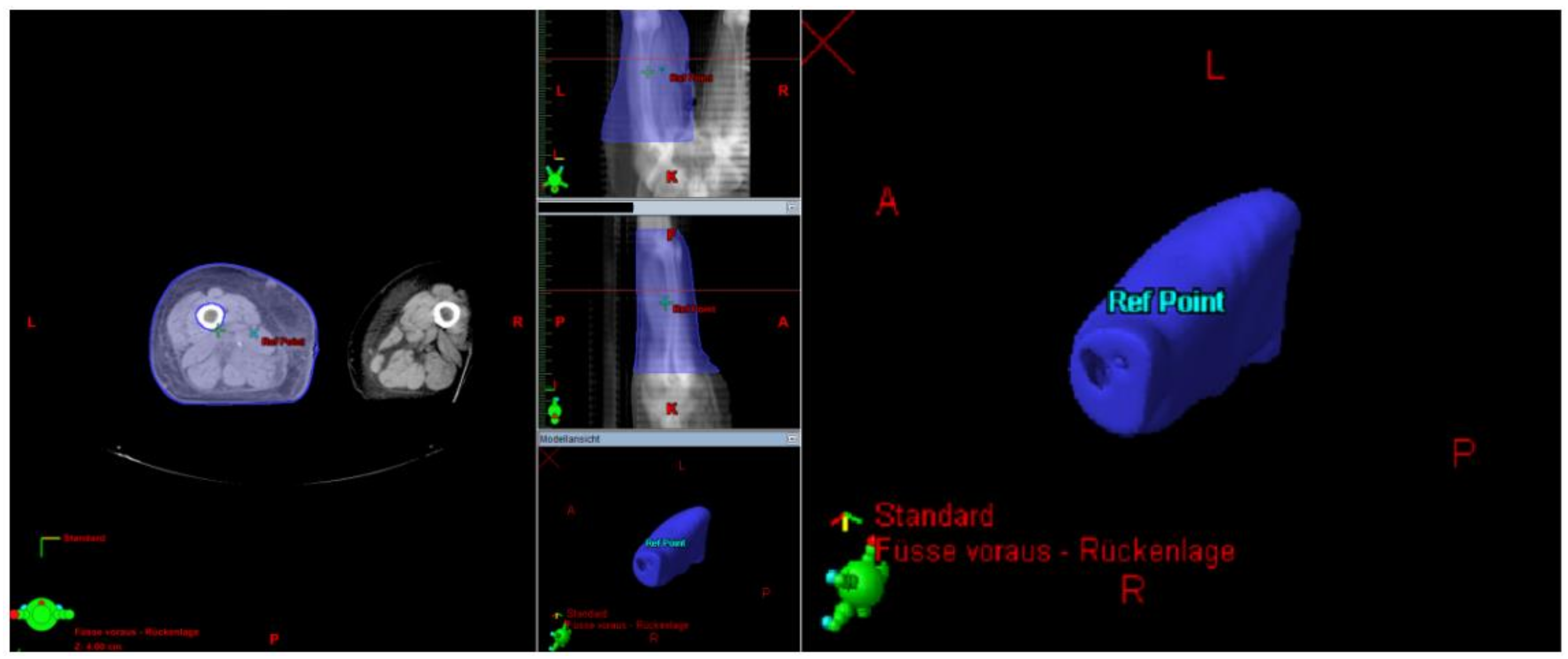 Cancers 13 02113 g004 Cancers 13 02113 g004