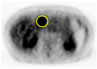 Cancers 13 02119 i002