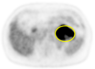 Cancers 13 02119 i004