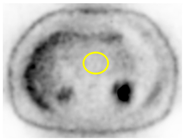 Cancers 13 02119 i010