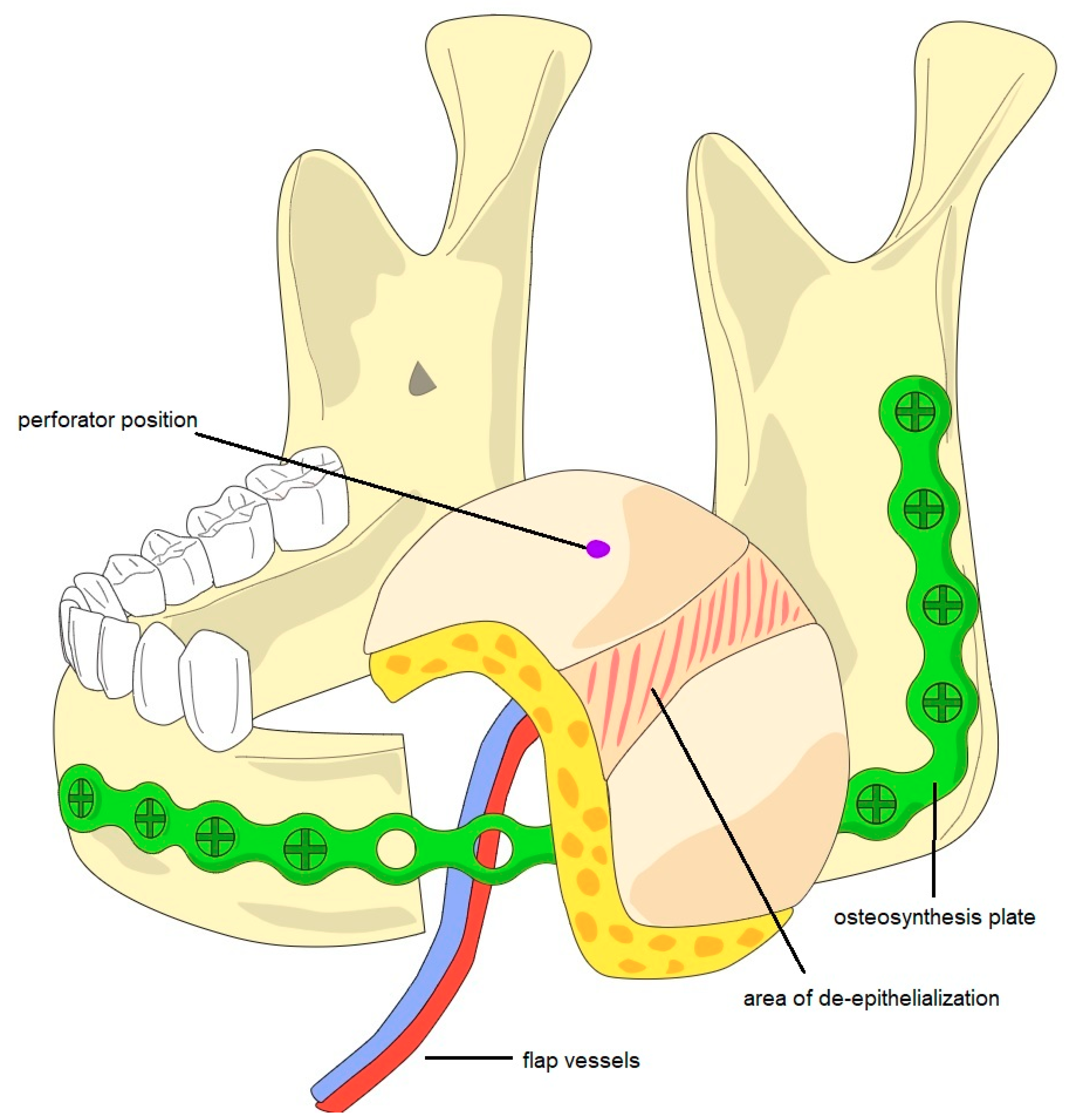 Cancers 13 02122 g001 Cancers 13 02122 g001