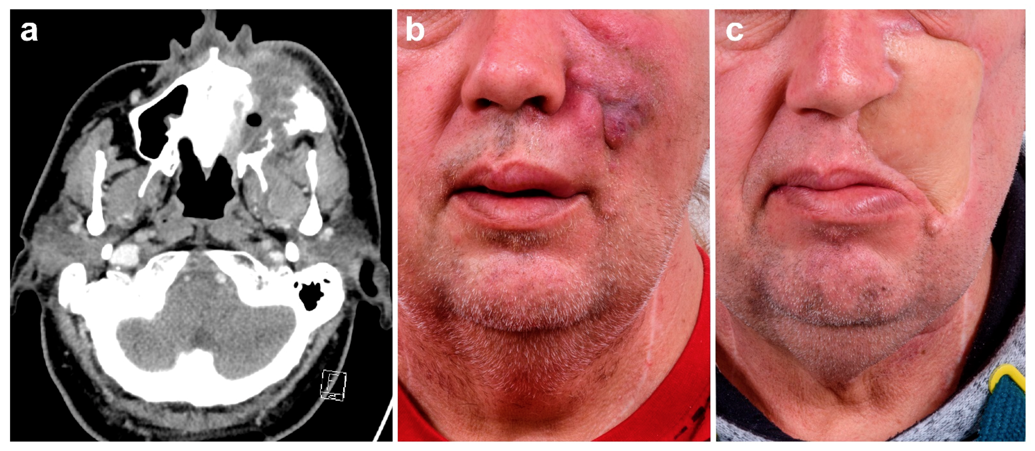 Cancers 13 02122 g003 Cancers 13 02122 g003