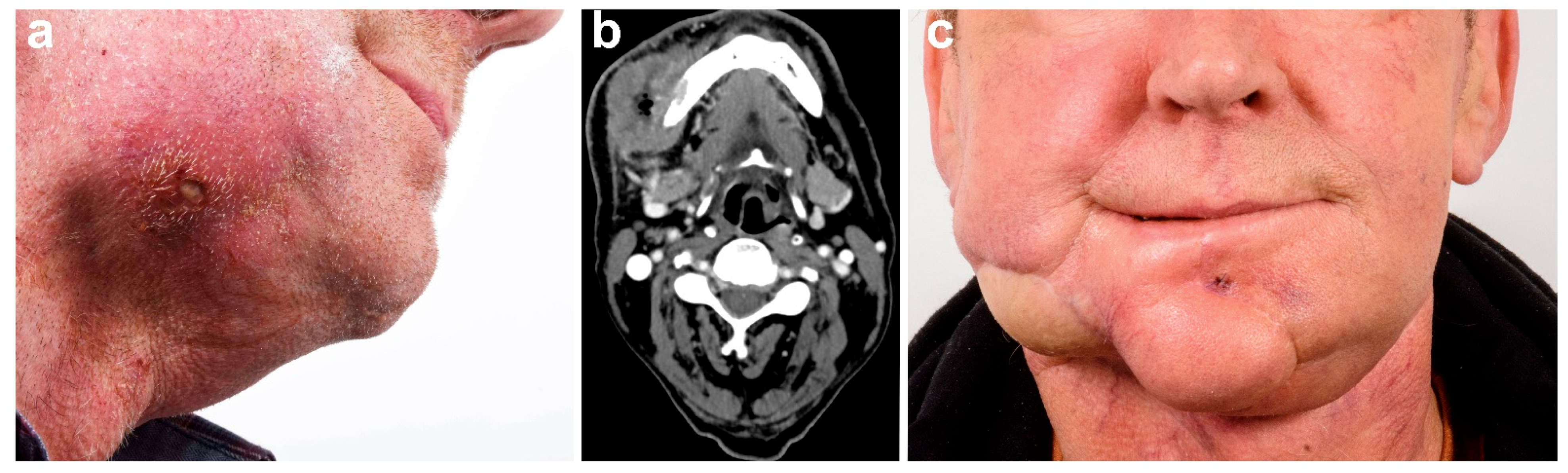 Cancers 13 02122 g004 Cancers 13 02122 g004