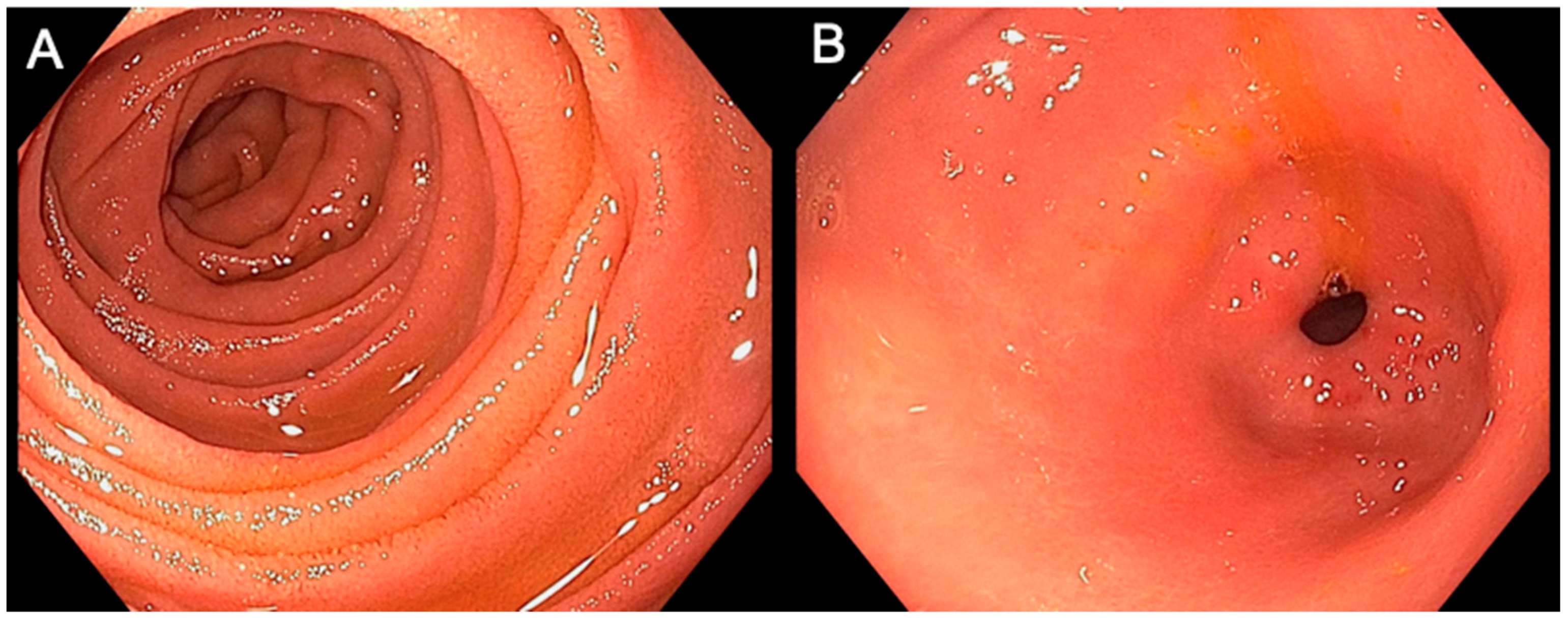 Cancers 13 02136 g002