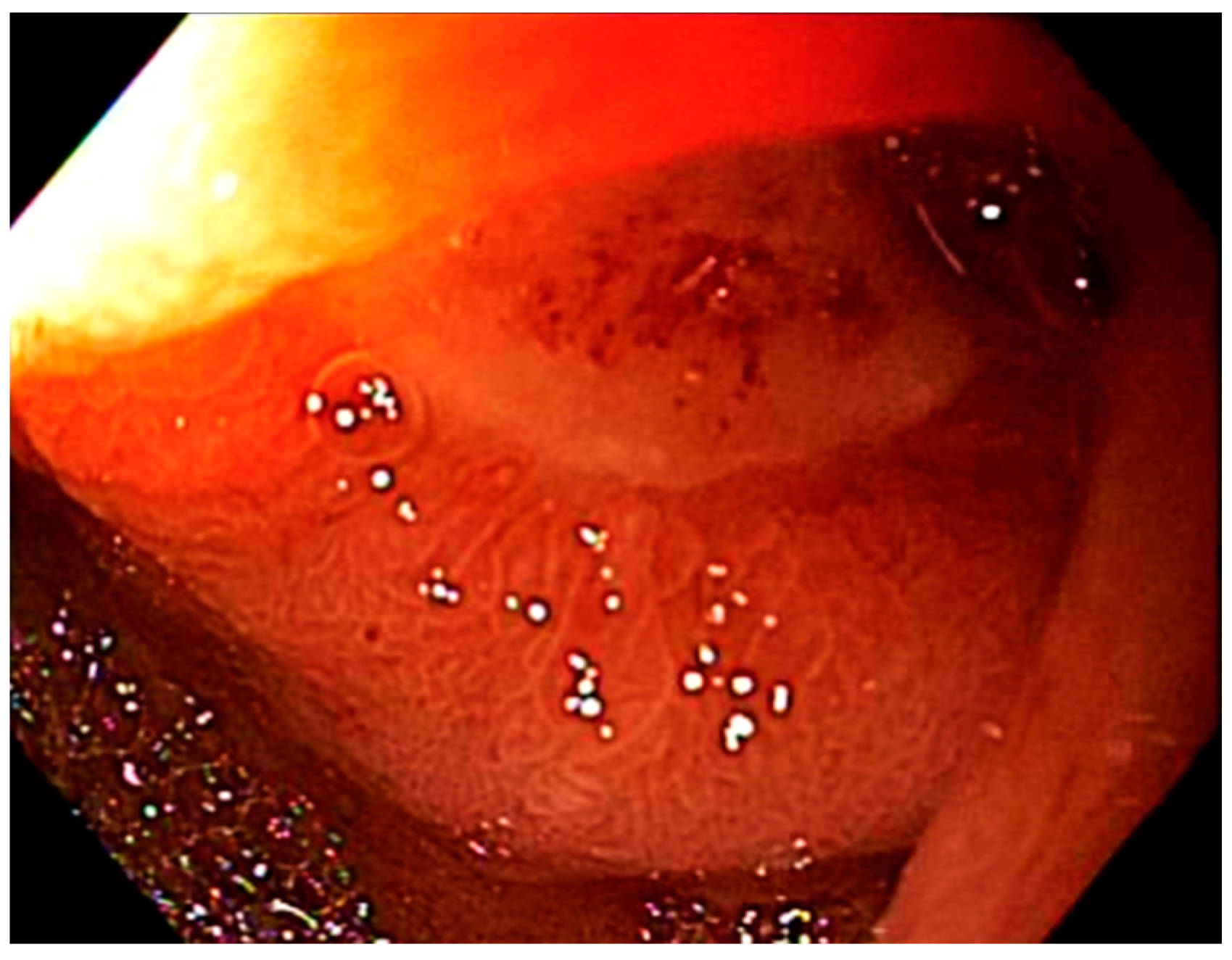 Cancers 13 02136 g003