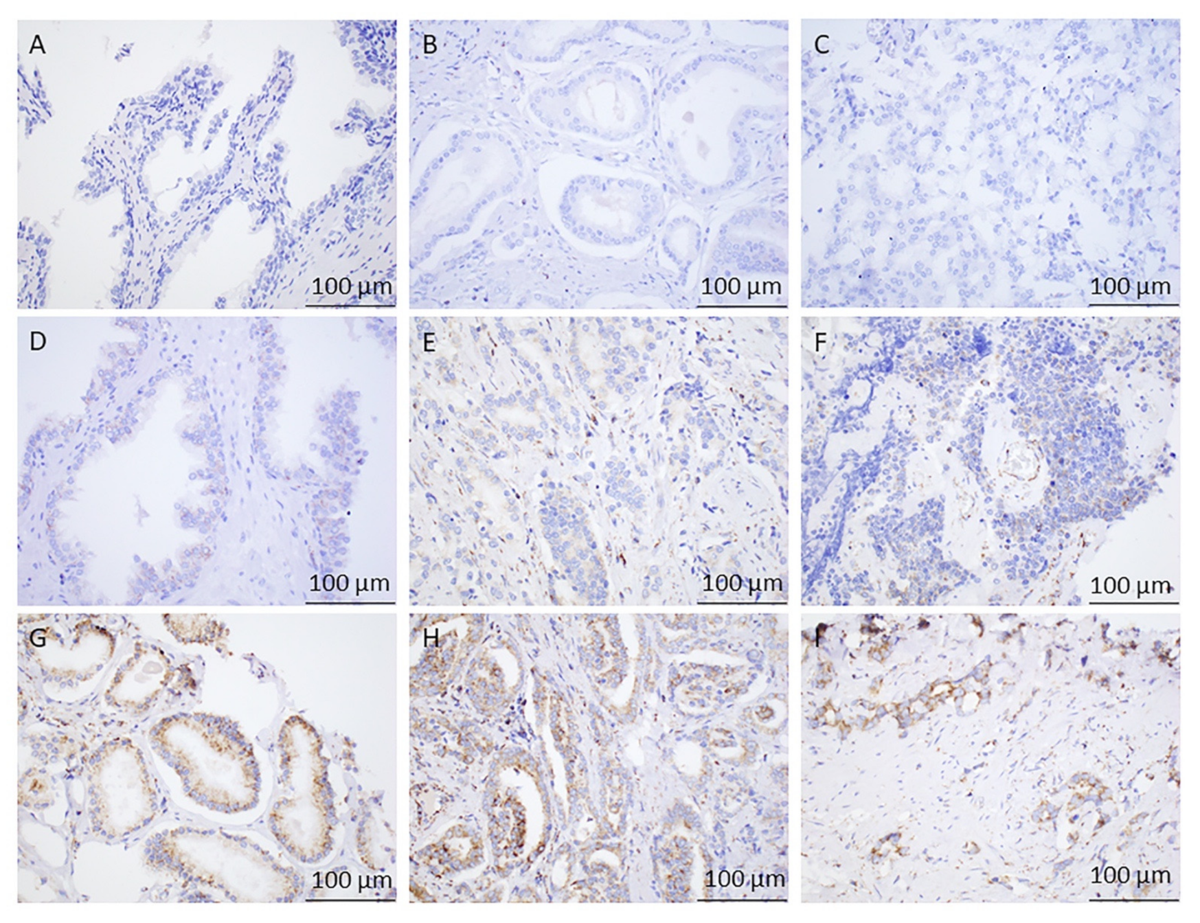 Cancers 13 02157 g002