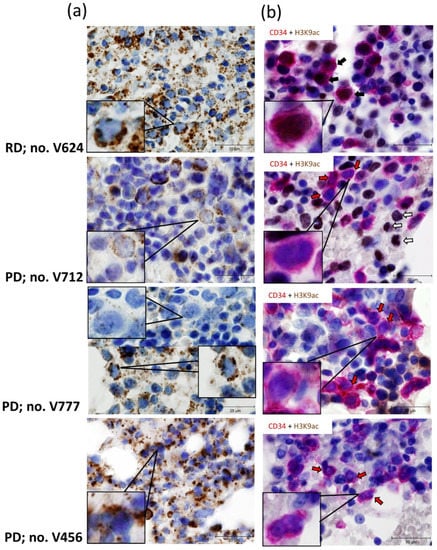 Cancers 13 02161 g005