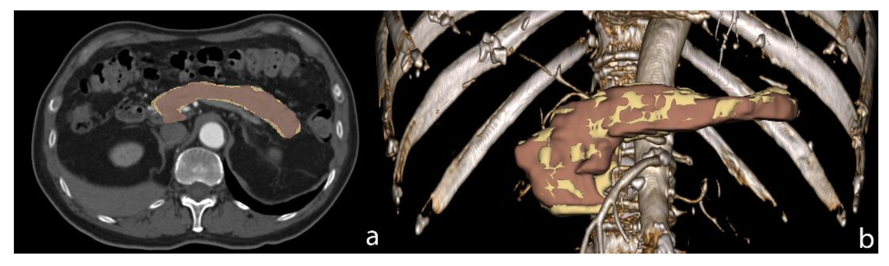Cancers 13 02162 g001