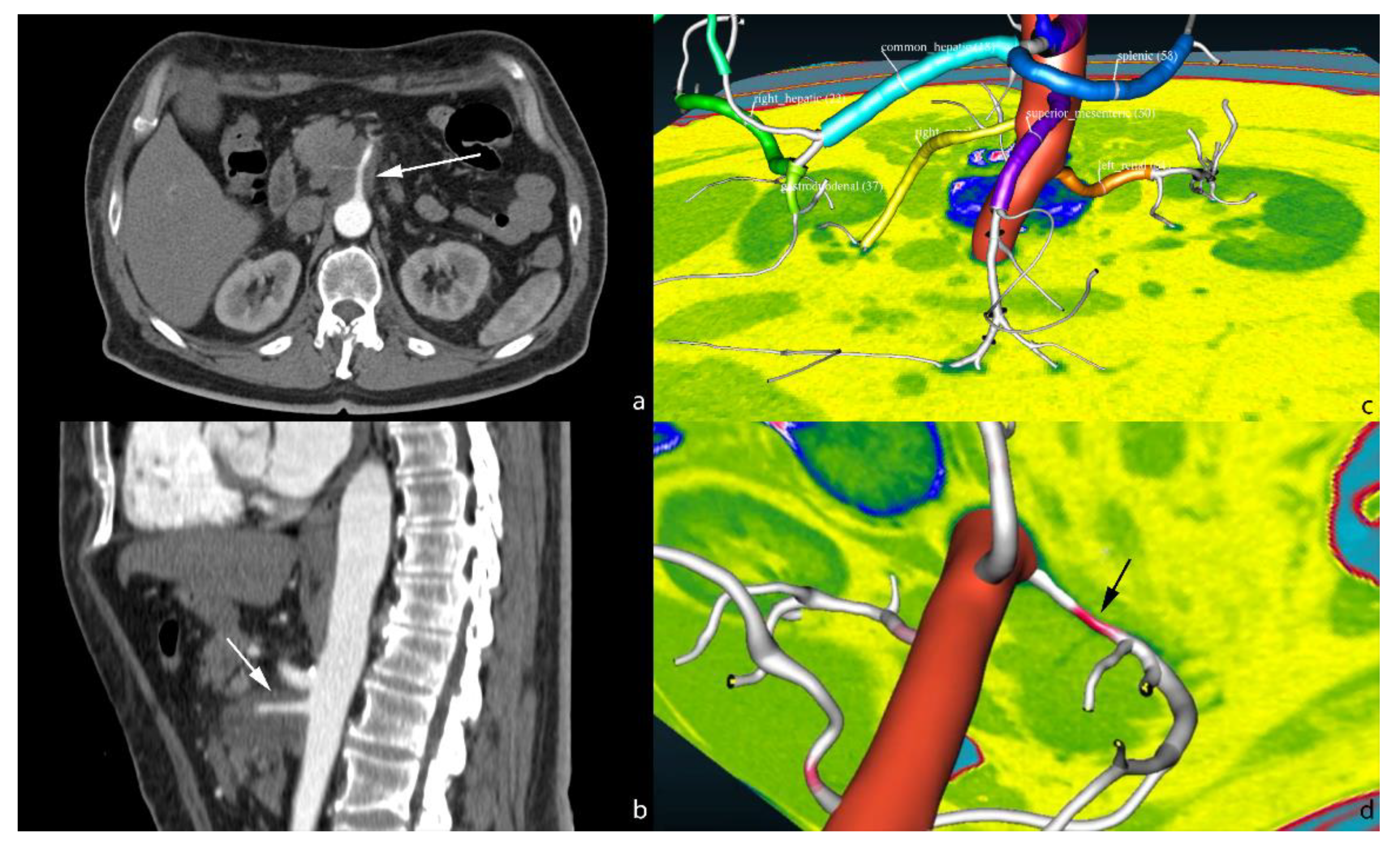 Cancers 13 02162 g005