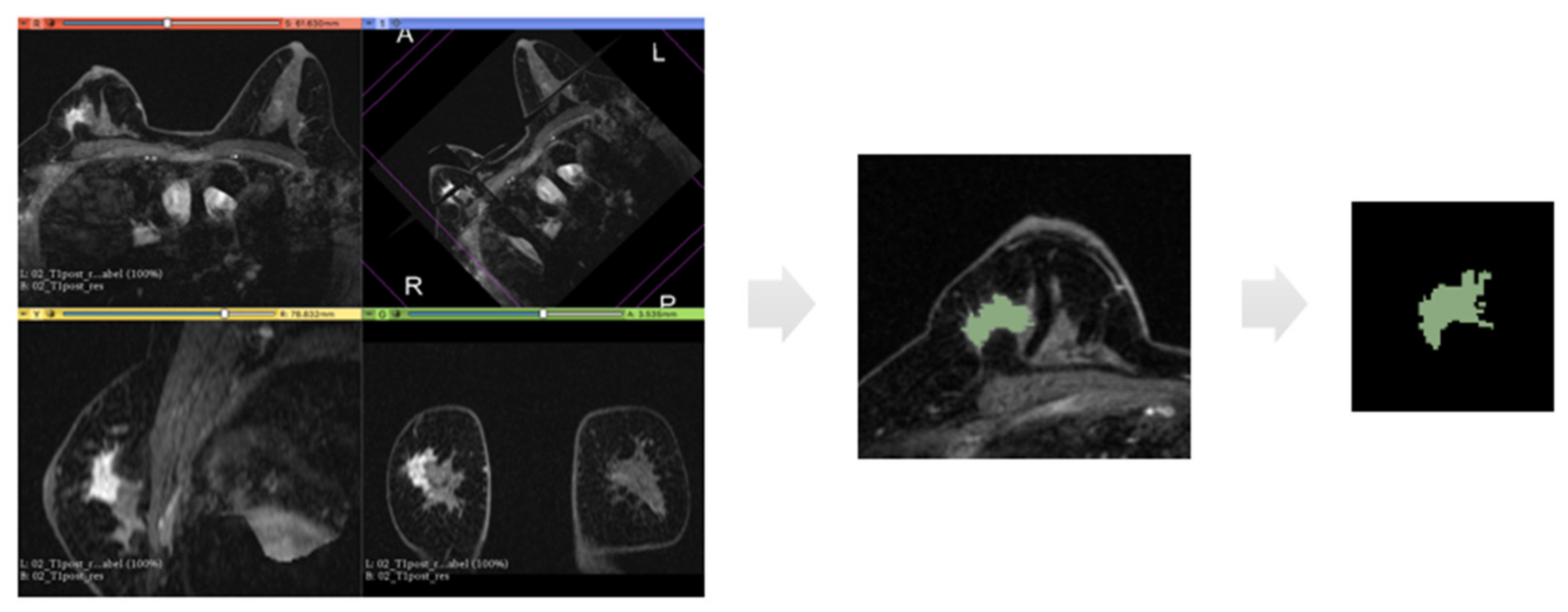 Cancers 13 02228 g002