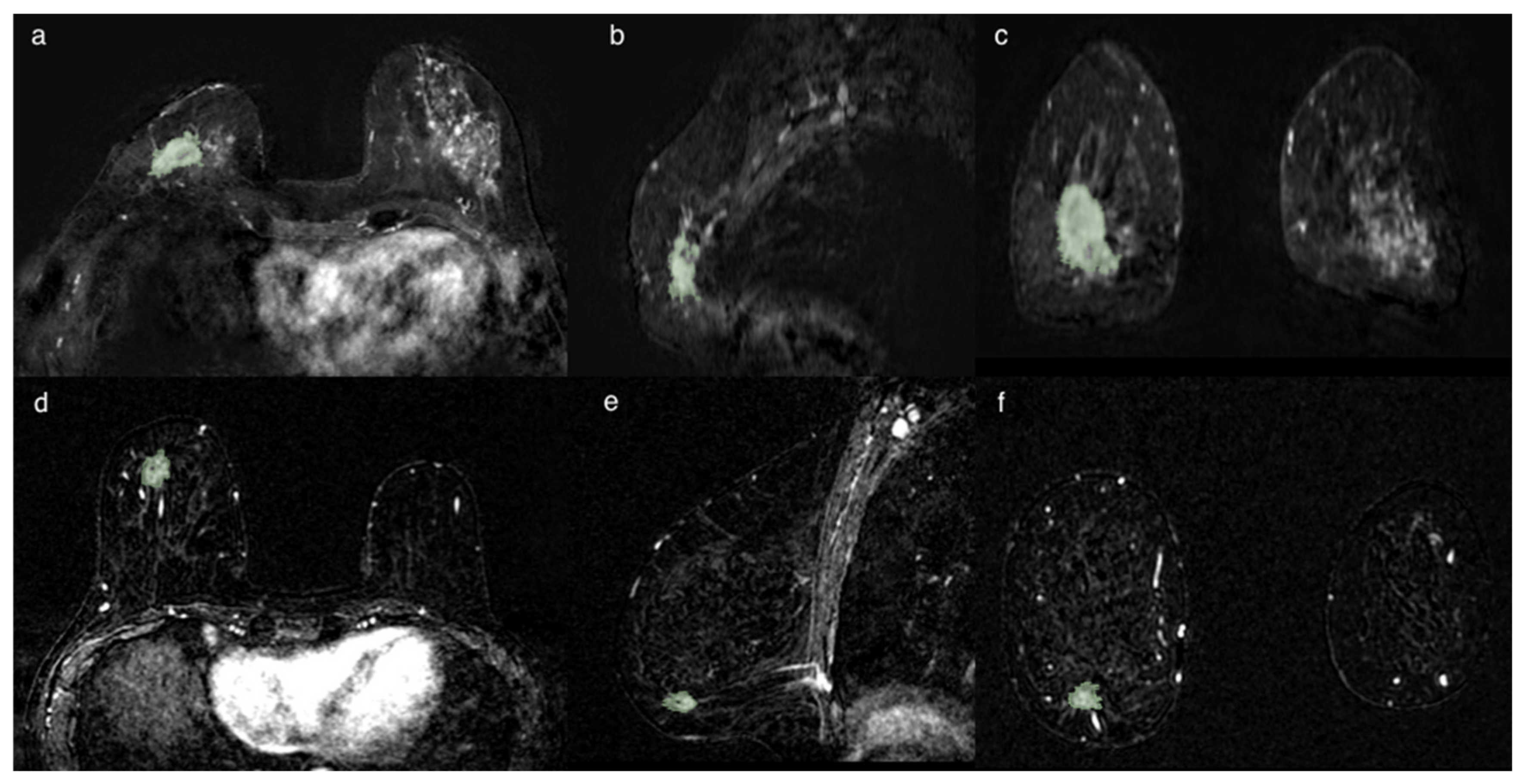 Cancers 13 02228 g003