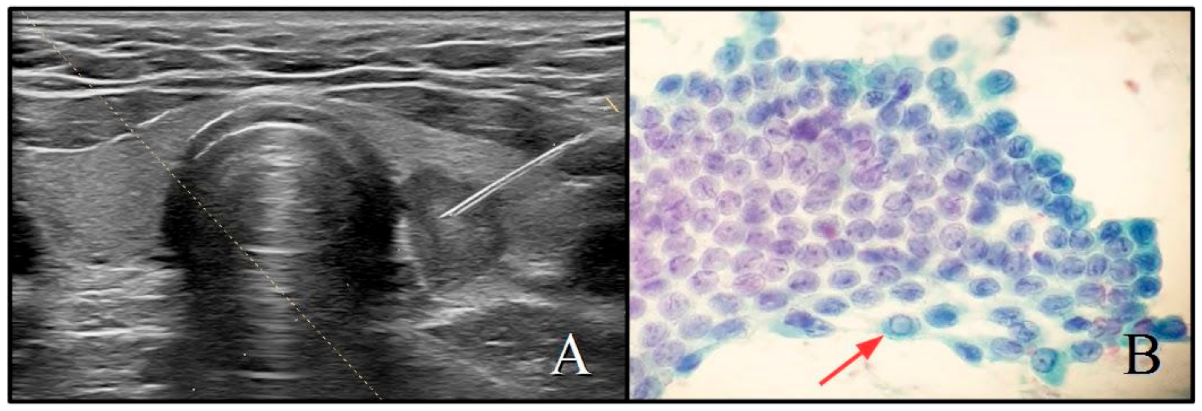 Cancers 13 02230 g002