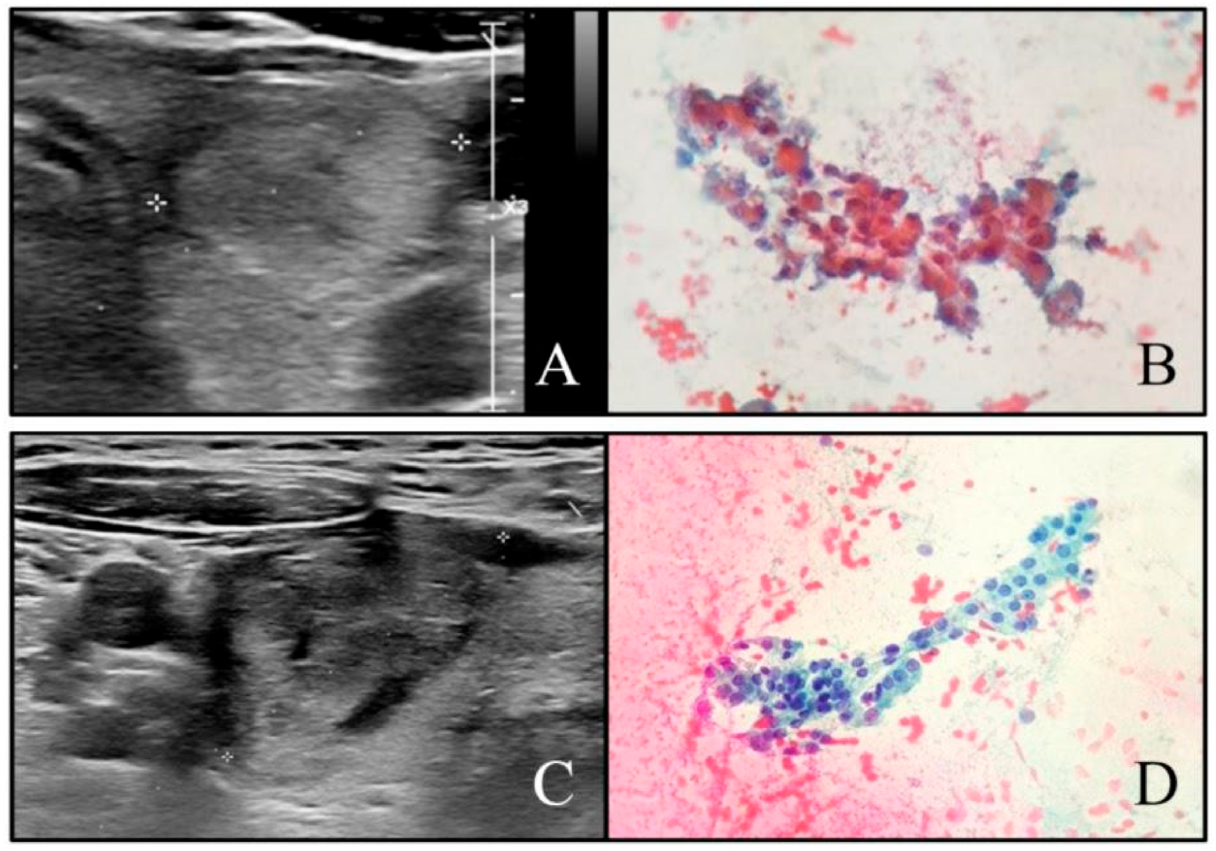 Cancers 13 02230 g003