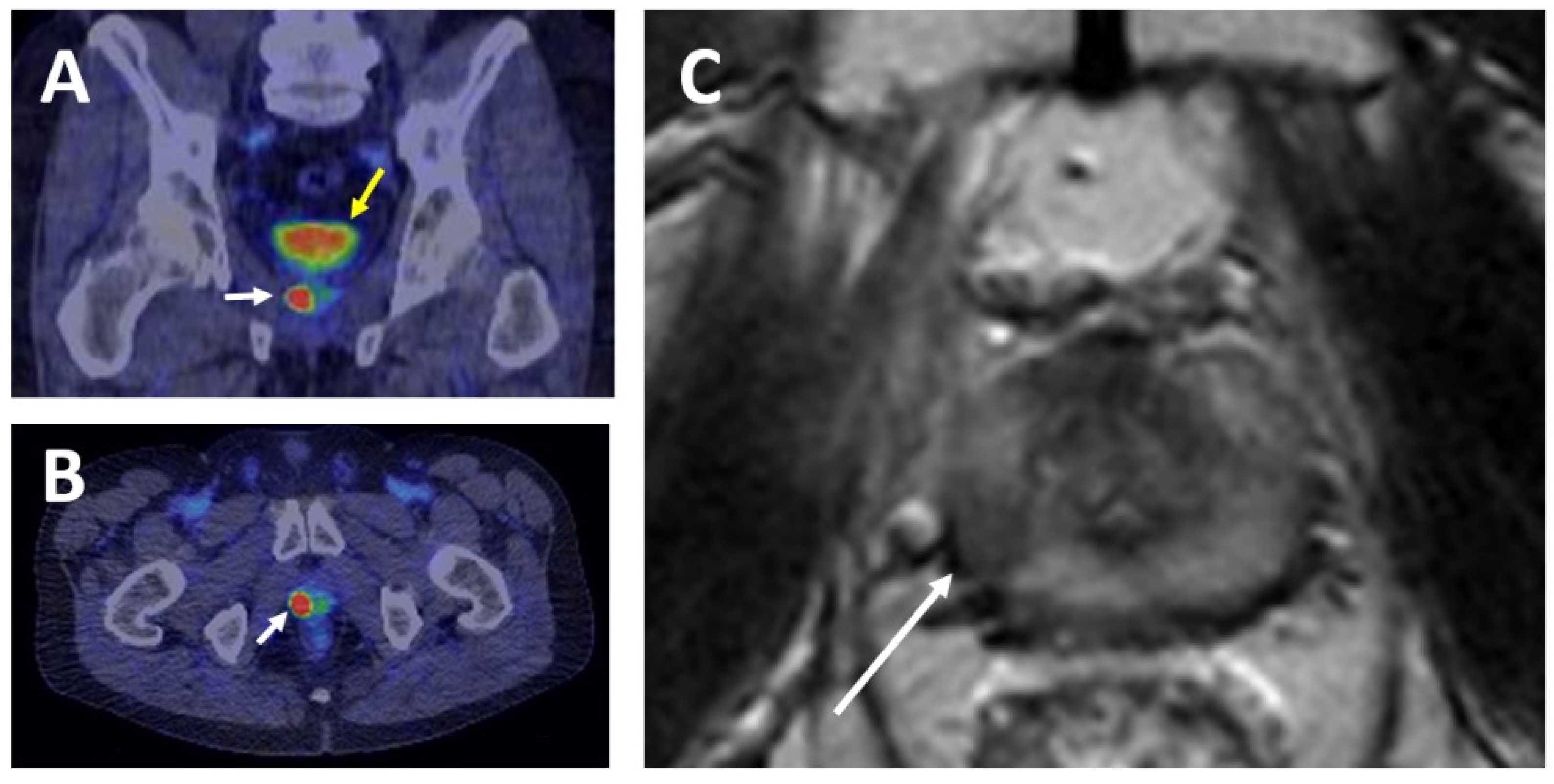 Cancers 13 02244 g003