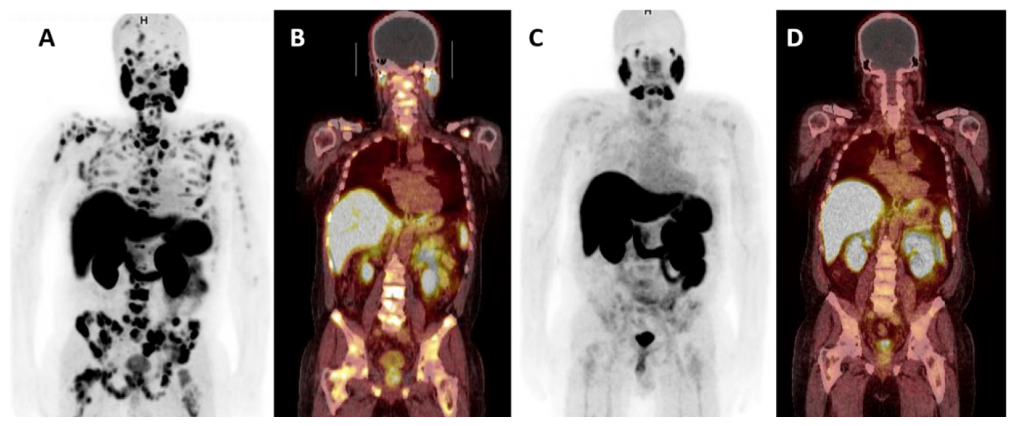 Cancers 13 02244 g004