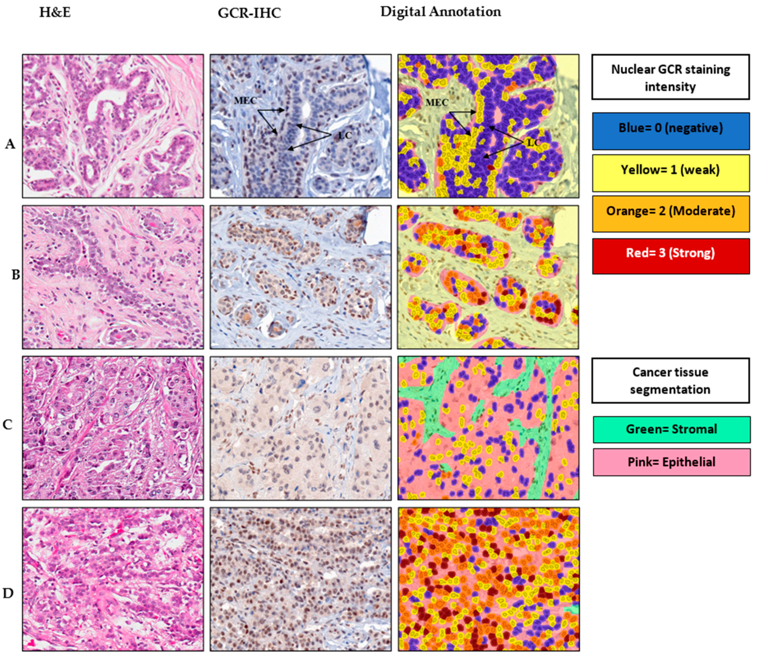 Cancers 13 02261 g001