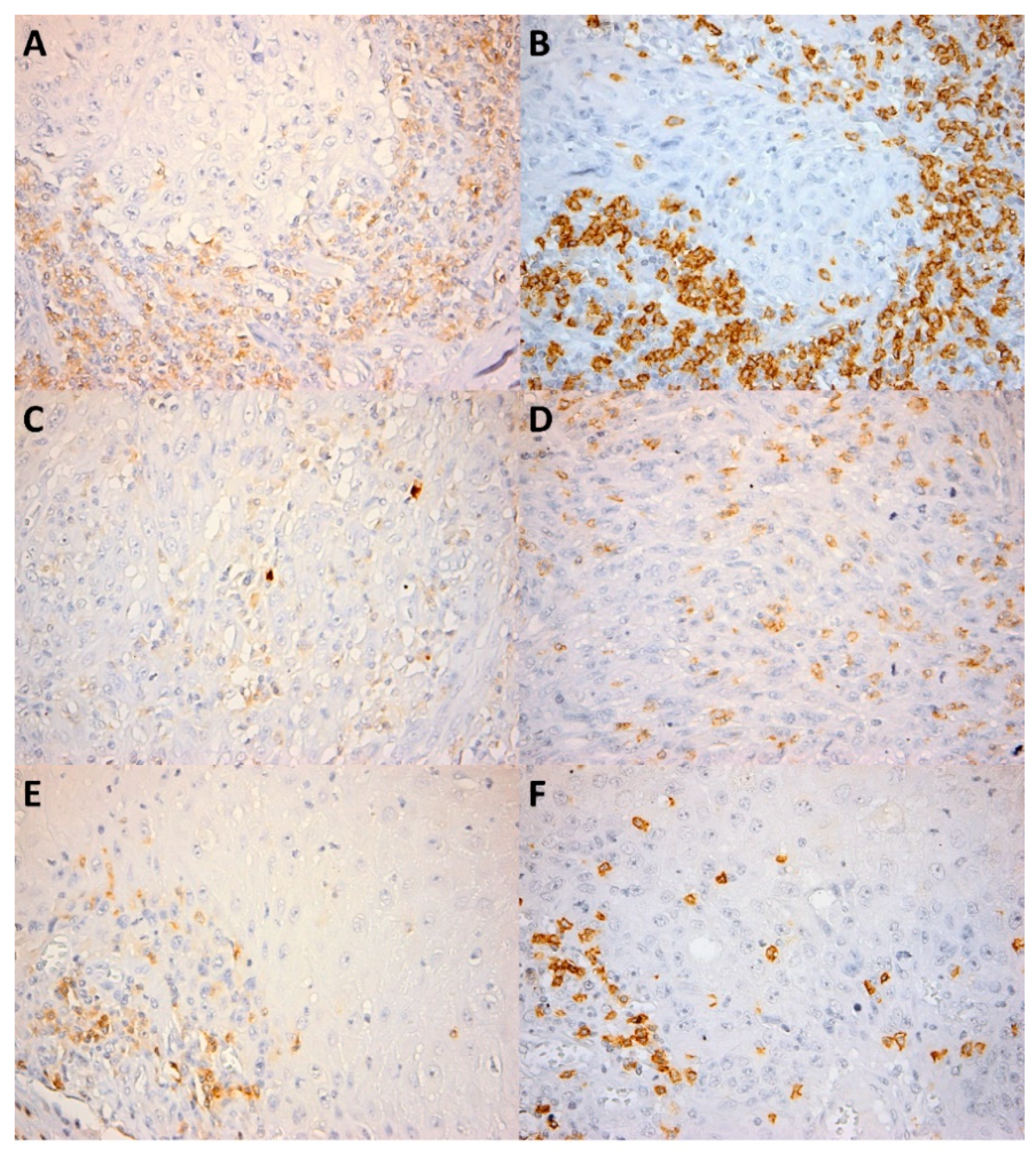 Cancers 13 02268 g001