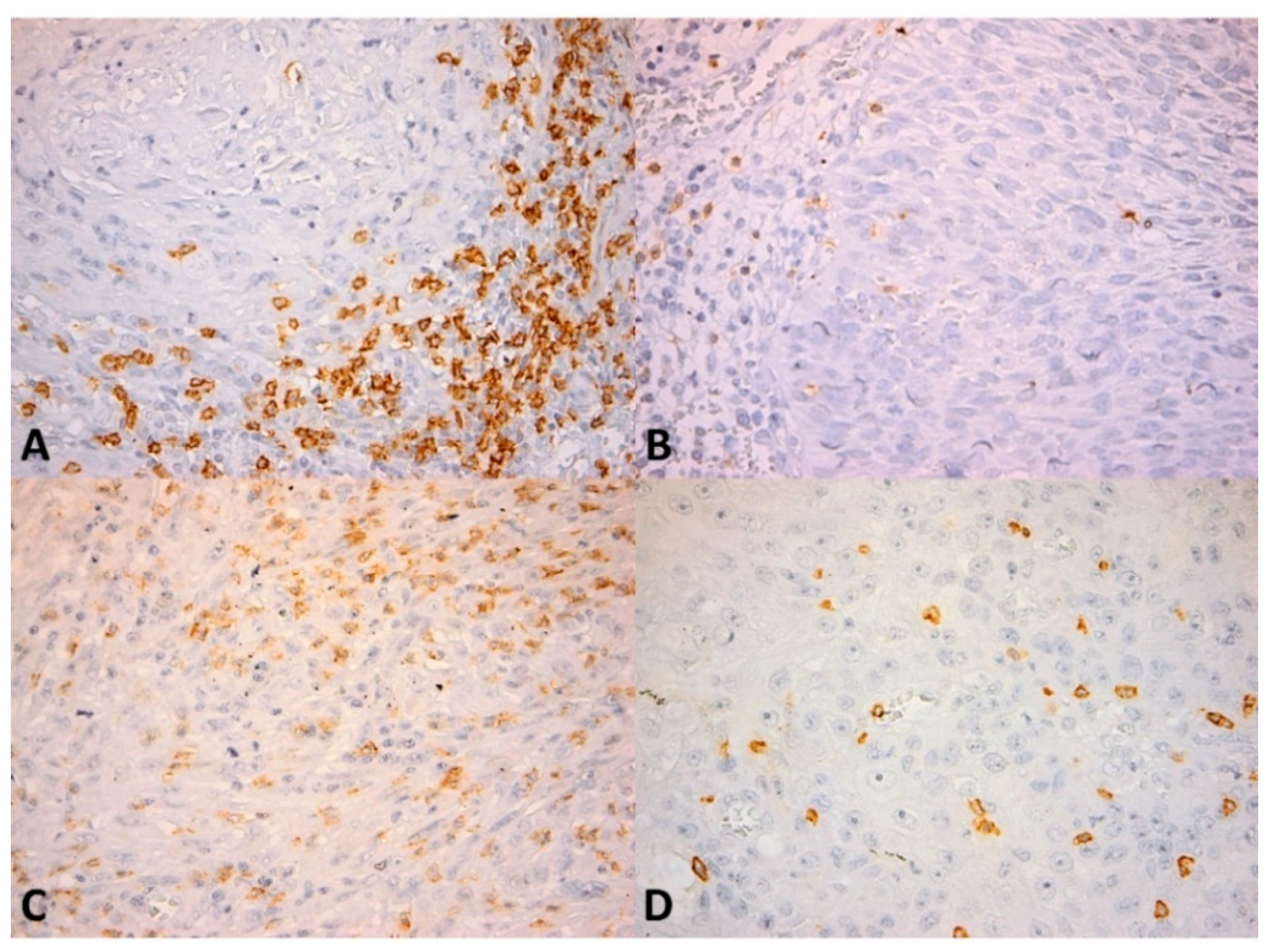 Cancers 13 02268 g002