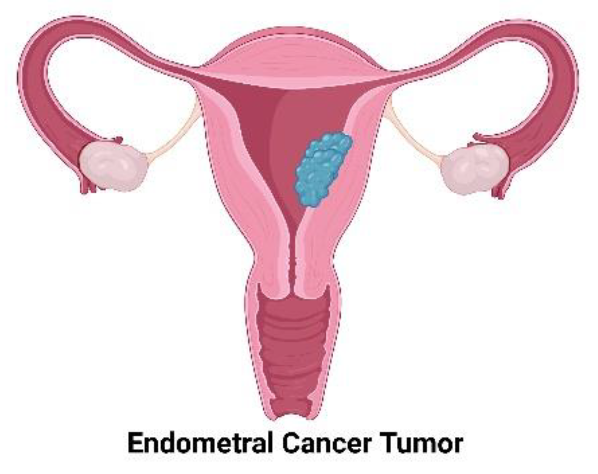 Cancers 13 02351 g003