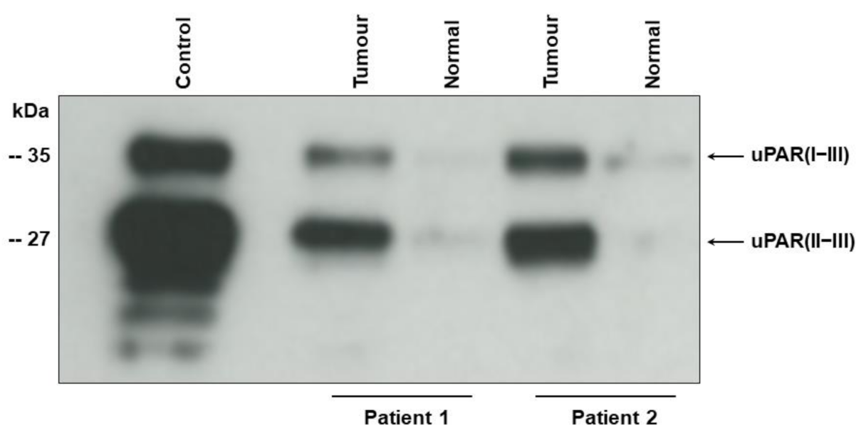 Cancers 13 02377 g001