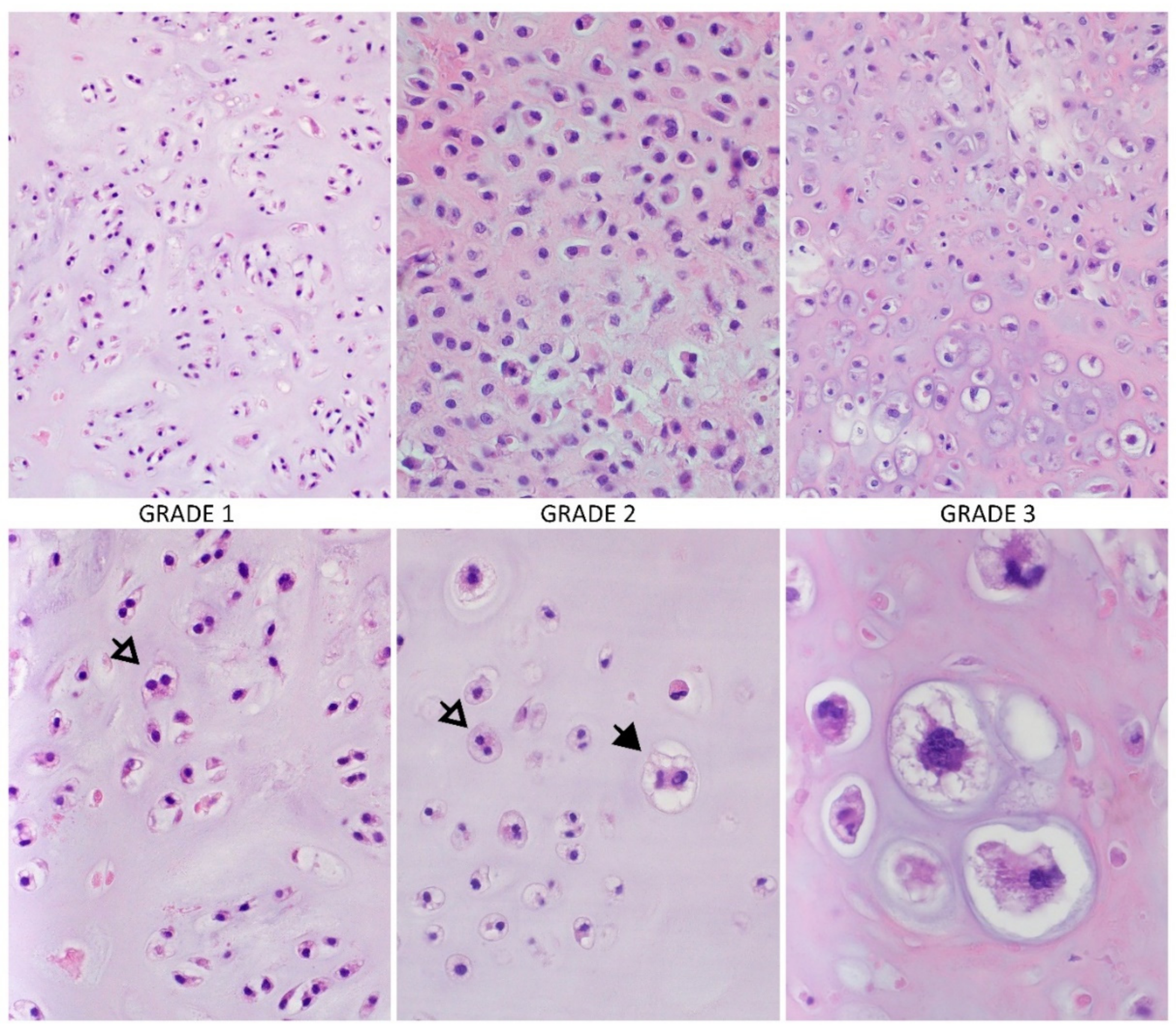 Cancers 13 02390 g001 Cancers 13 02390 g001