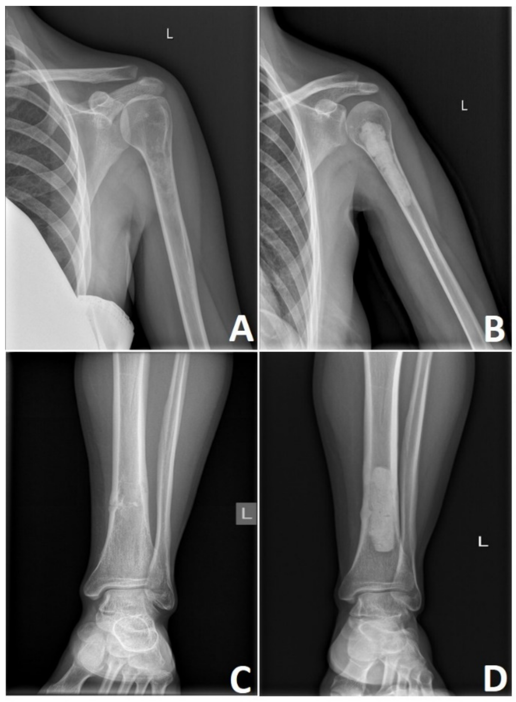 Cancers 13 02390 g007 Cancers 13 02390 g007