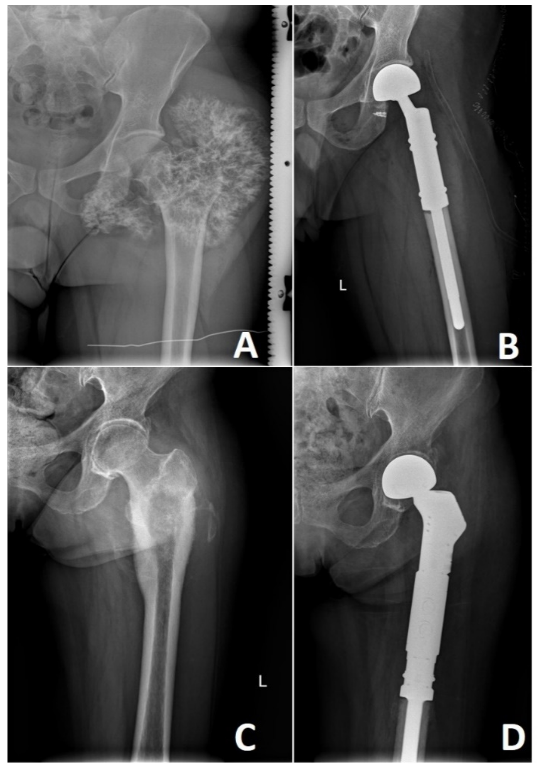 Cancers 13 02390 g008 Cancers 13 02390 g008