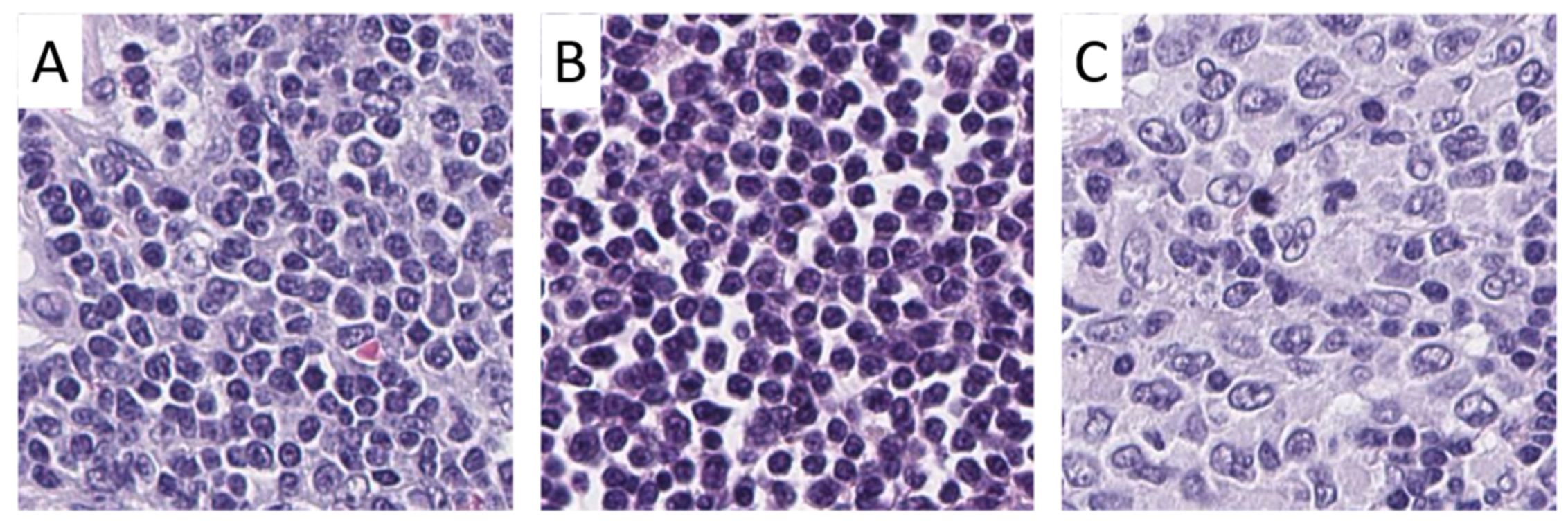 Cancers 13 02419 g002