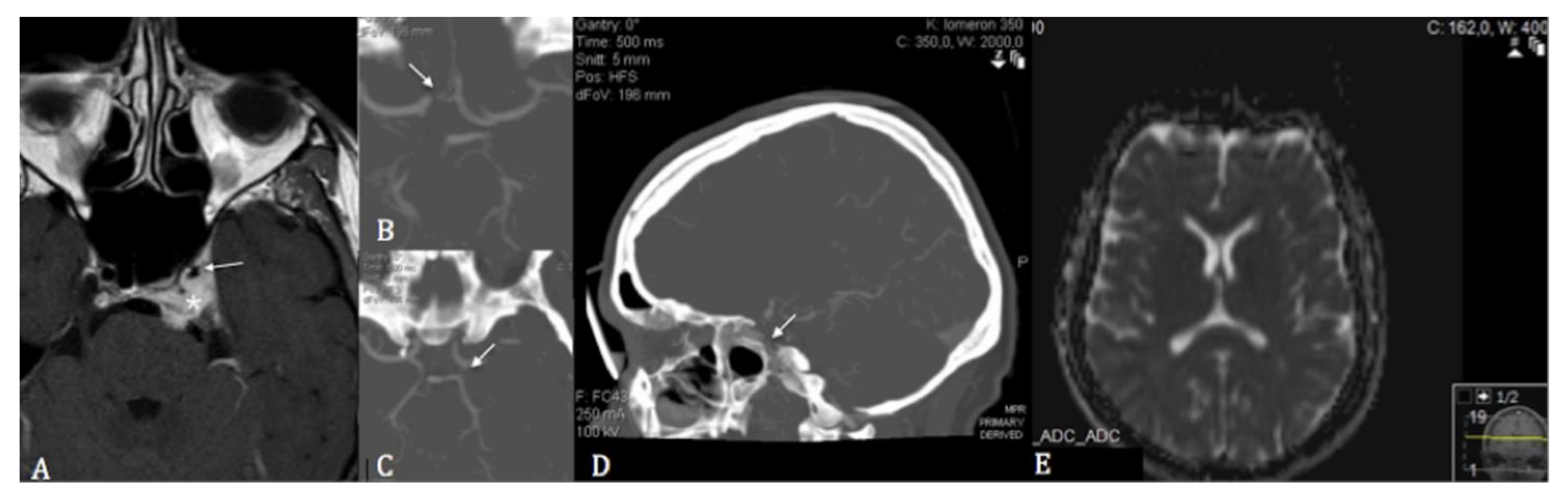 Cancers 13 02420 g001