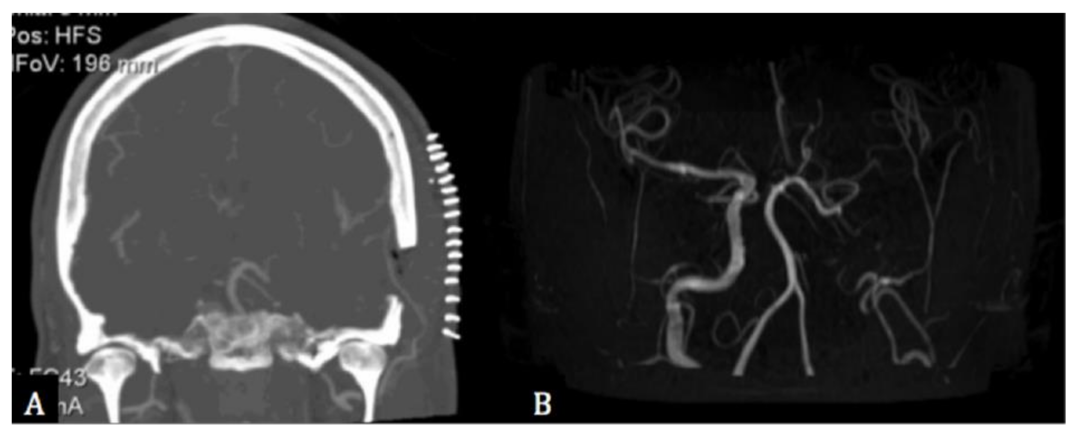 Cancers 13 02420 g003
