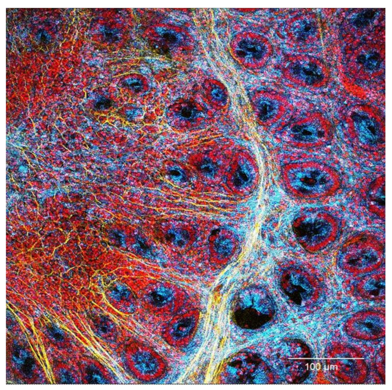 Cancers 13 02463 g001 Cancers 13 02463 g001