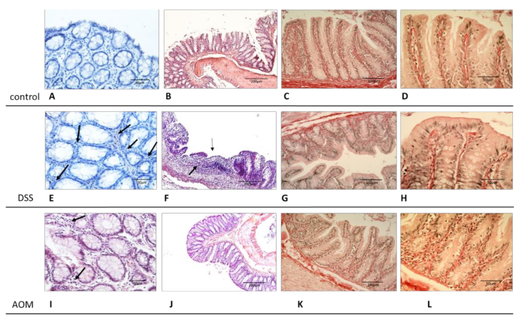 Cancers 13 02463 g003 Cancers 13 02463 g003
