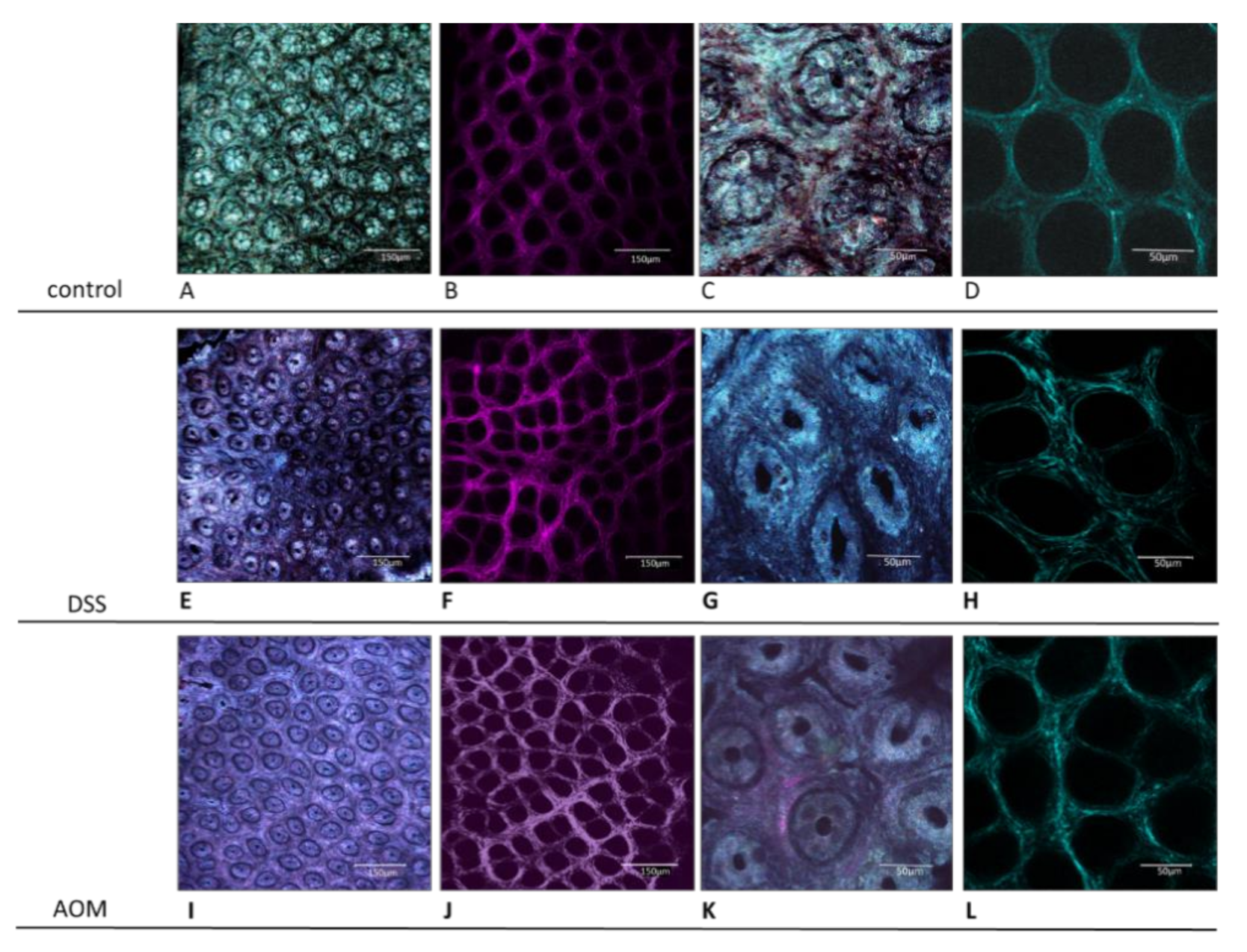 Cancers 13 02463 g004 Cancers 13 02463 g004