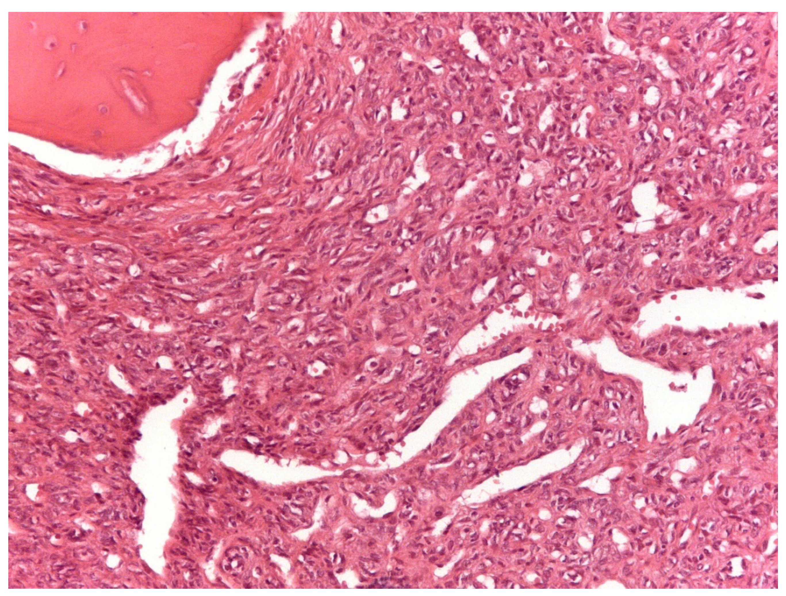 Cancers 13 02470 g001