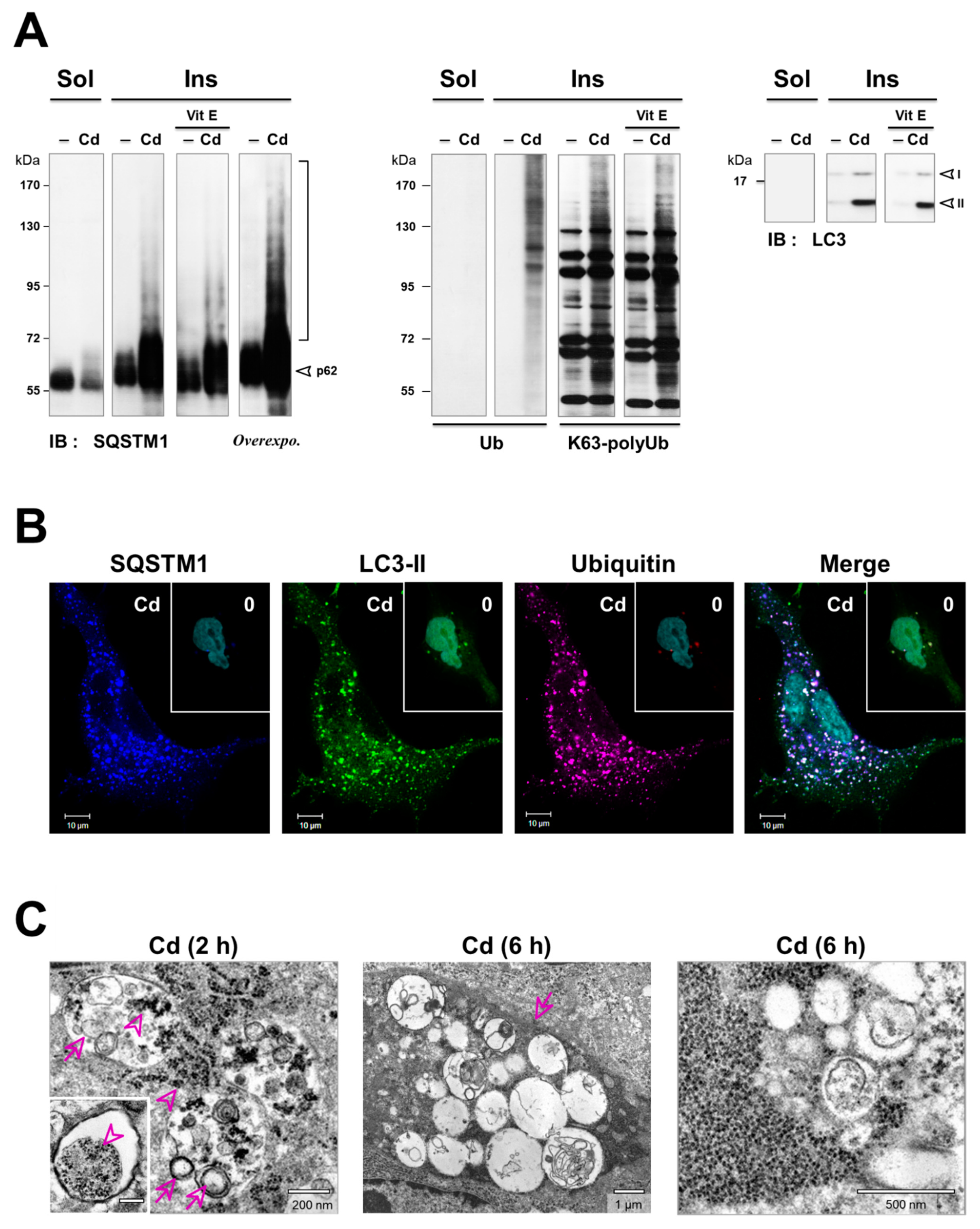 Cancers 13 02490 g005