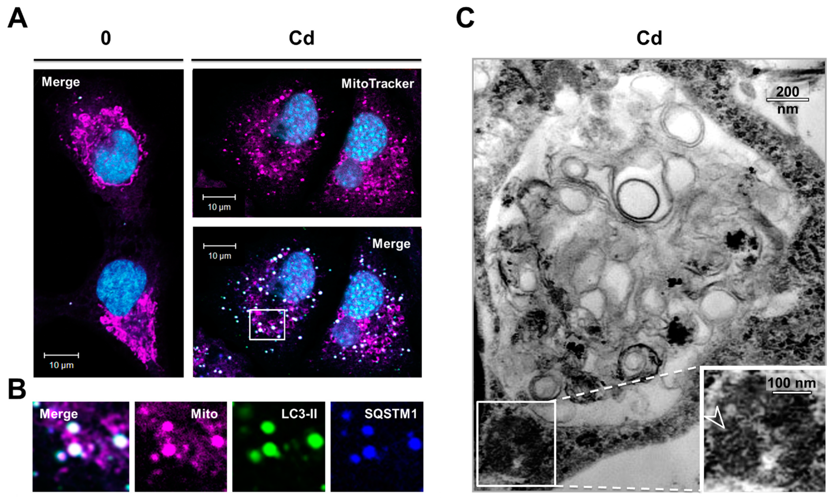 Cancers 13 02490 g006
