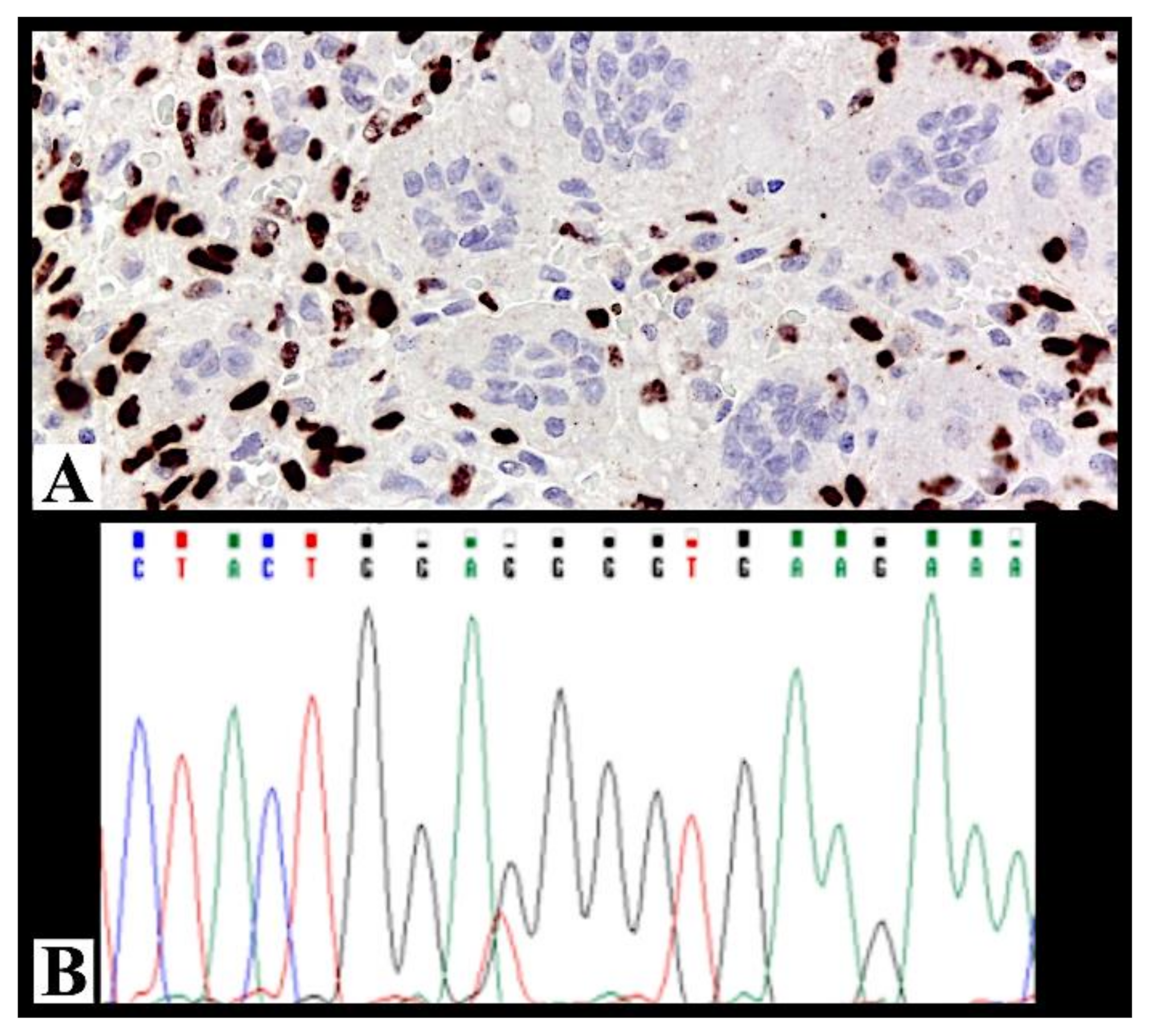 Cancers 13 02585 g001