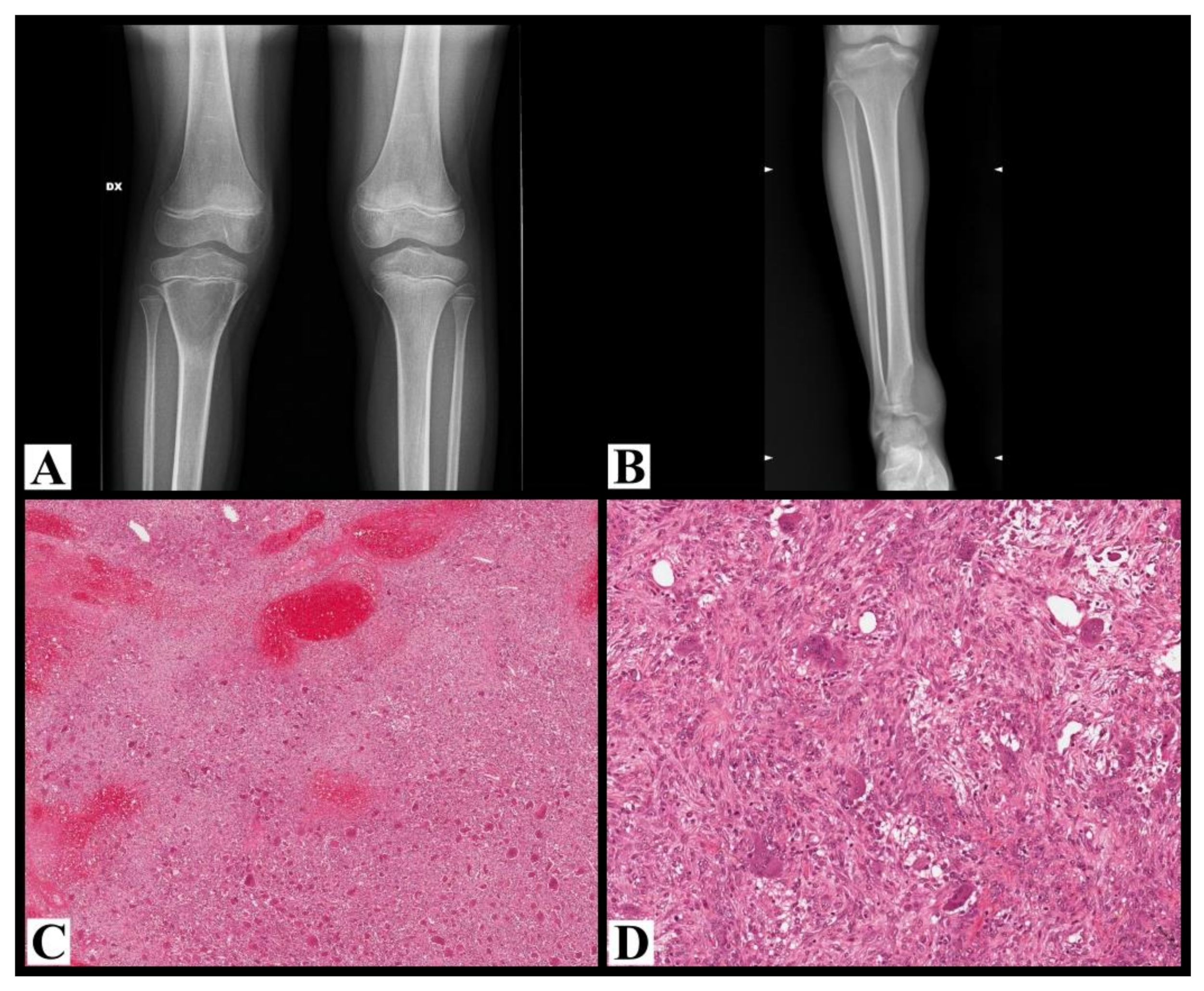 Cancers 13 02585 g002