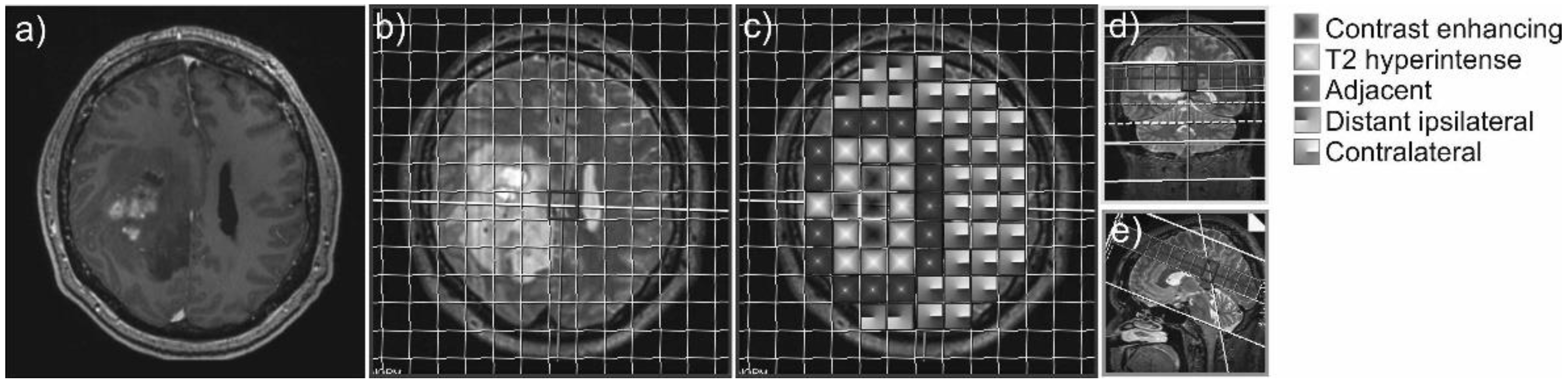 Cancers 13 02598 g001 Cancers 13 02598 g001